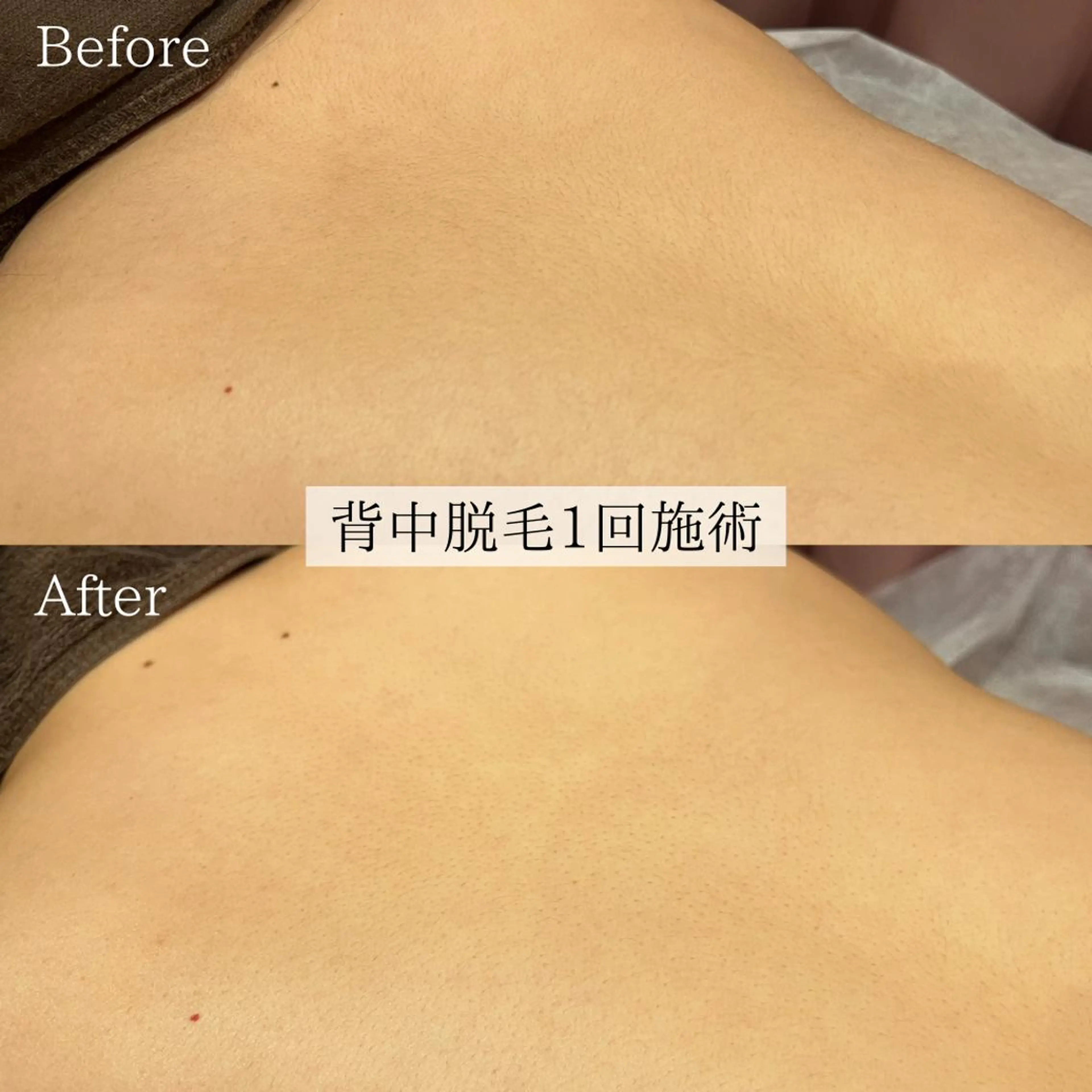 小顔美肌：ミアンカ 京阪モール本館1Fのエステ・リラクイメージ