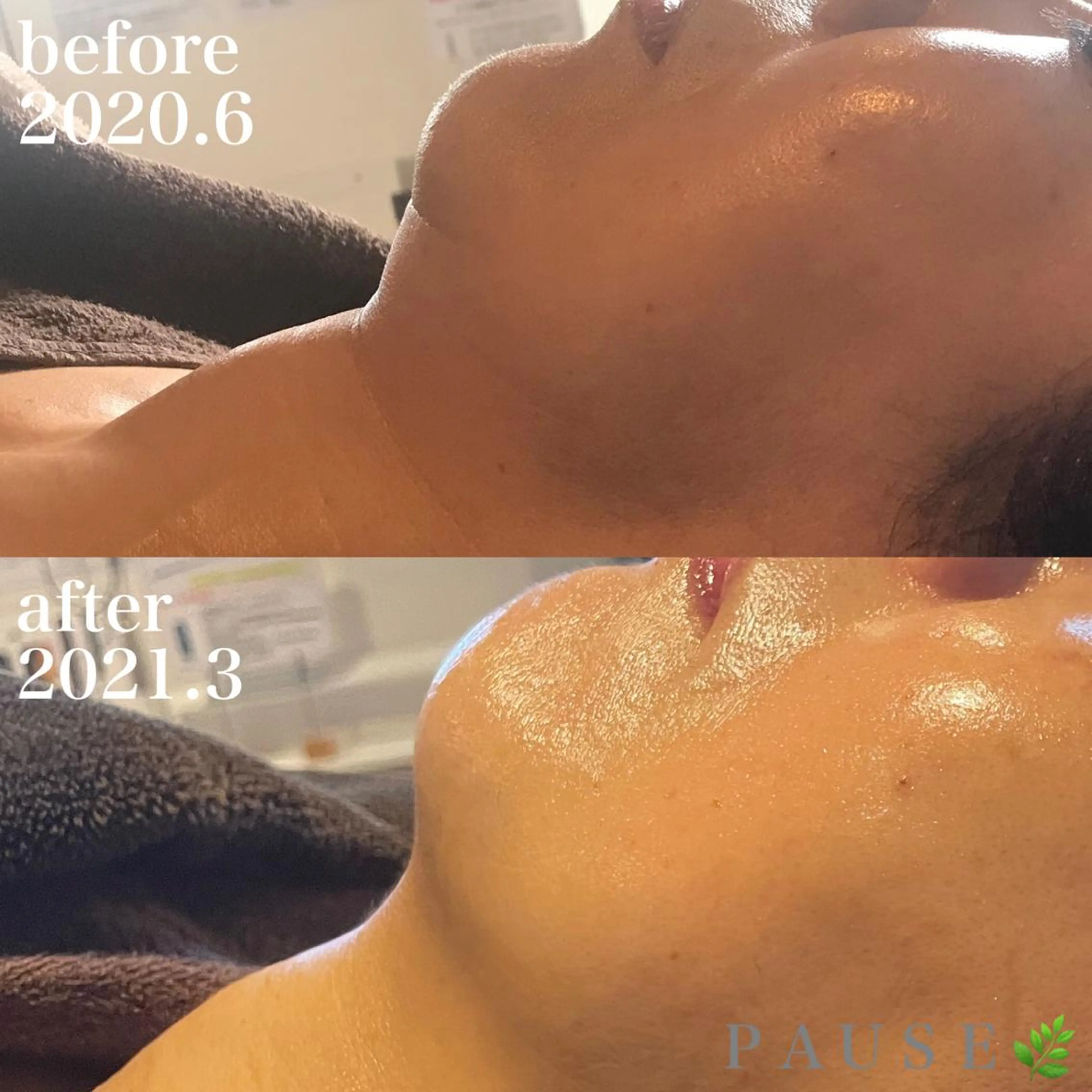 エステ 浜野 恵美のエステ・リラクイメージ