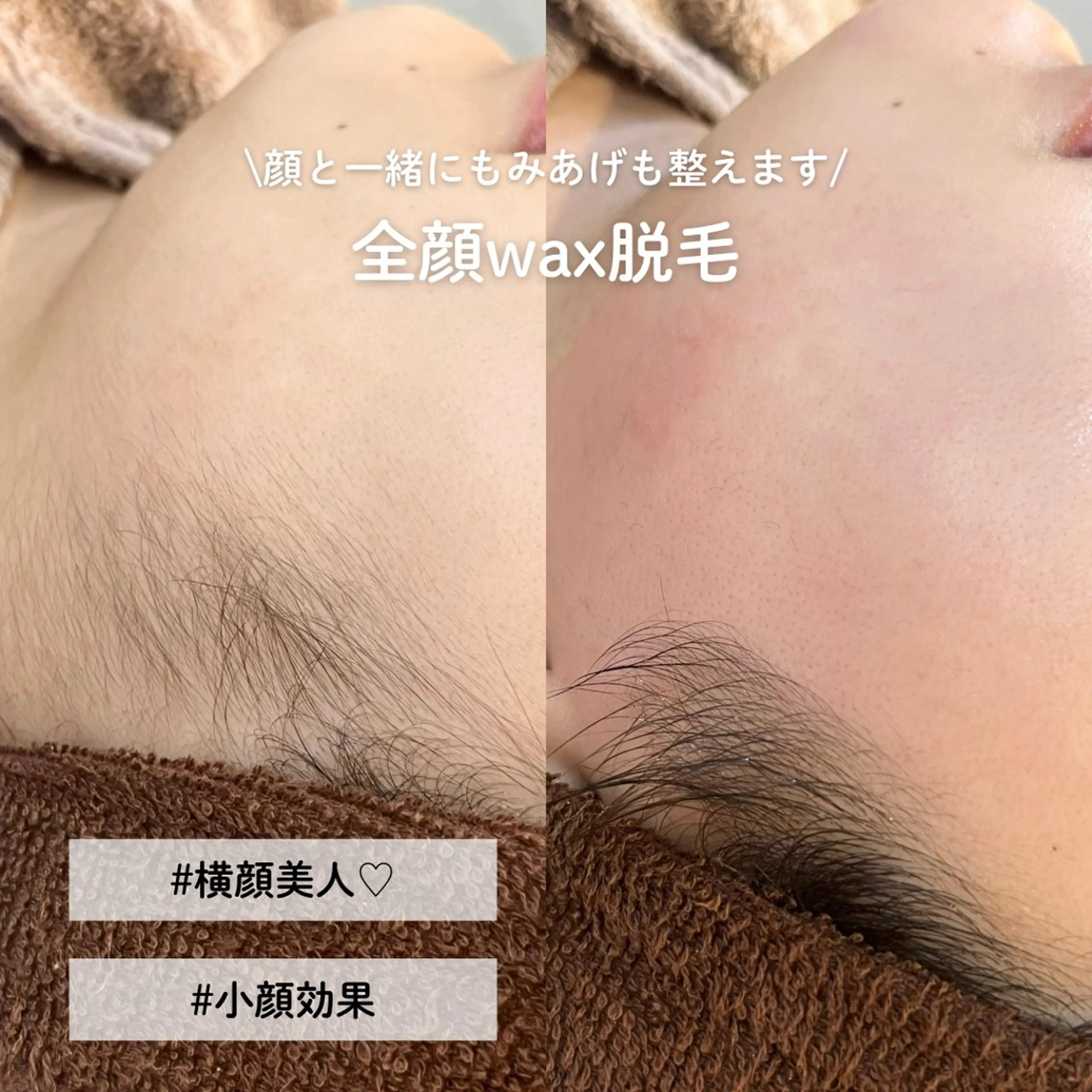 EST BEAUTY所属・顔ワックス脱毛/ ハーブピーリングのエステ・リラクイメージ