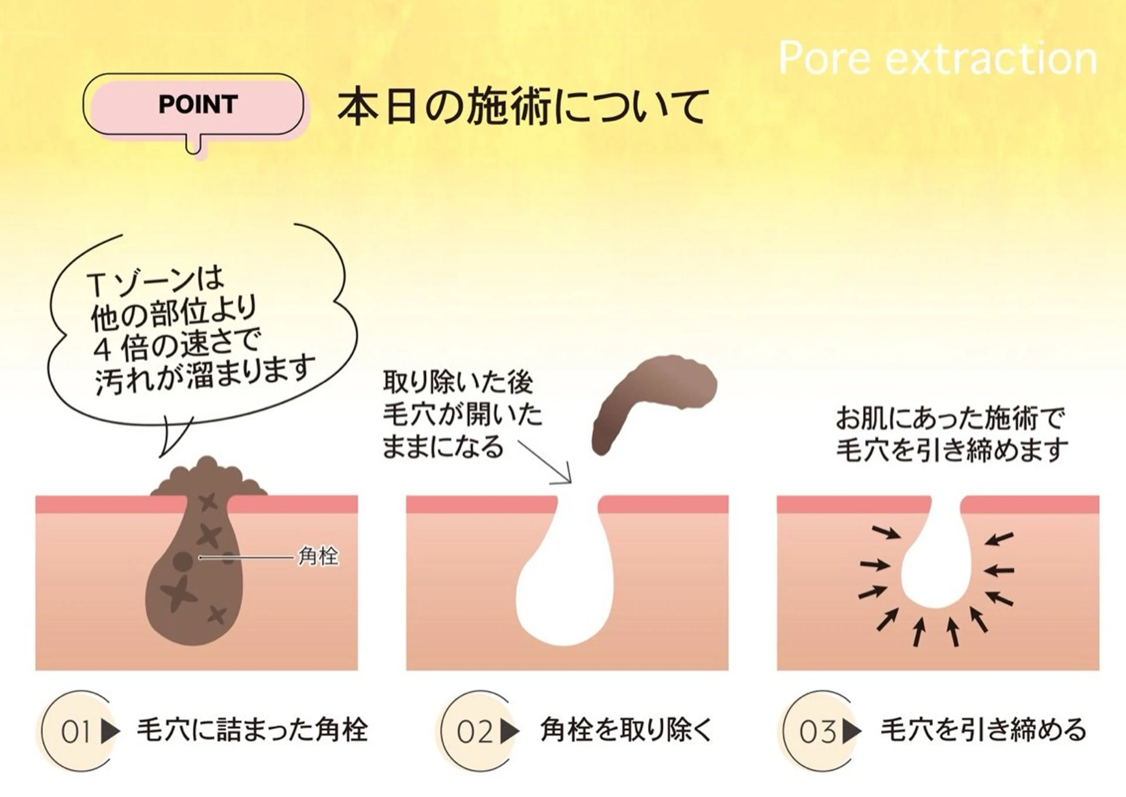 【毛穴専門店】 瑞江|yukaのエステ・リラクイメージ