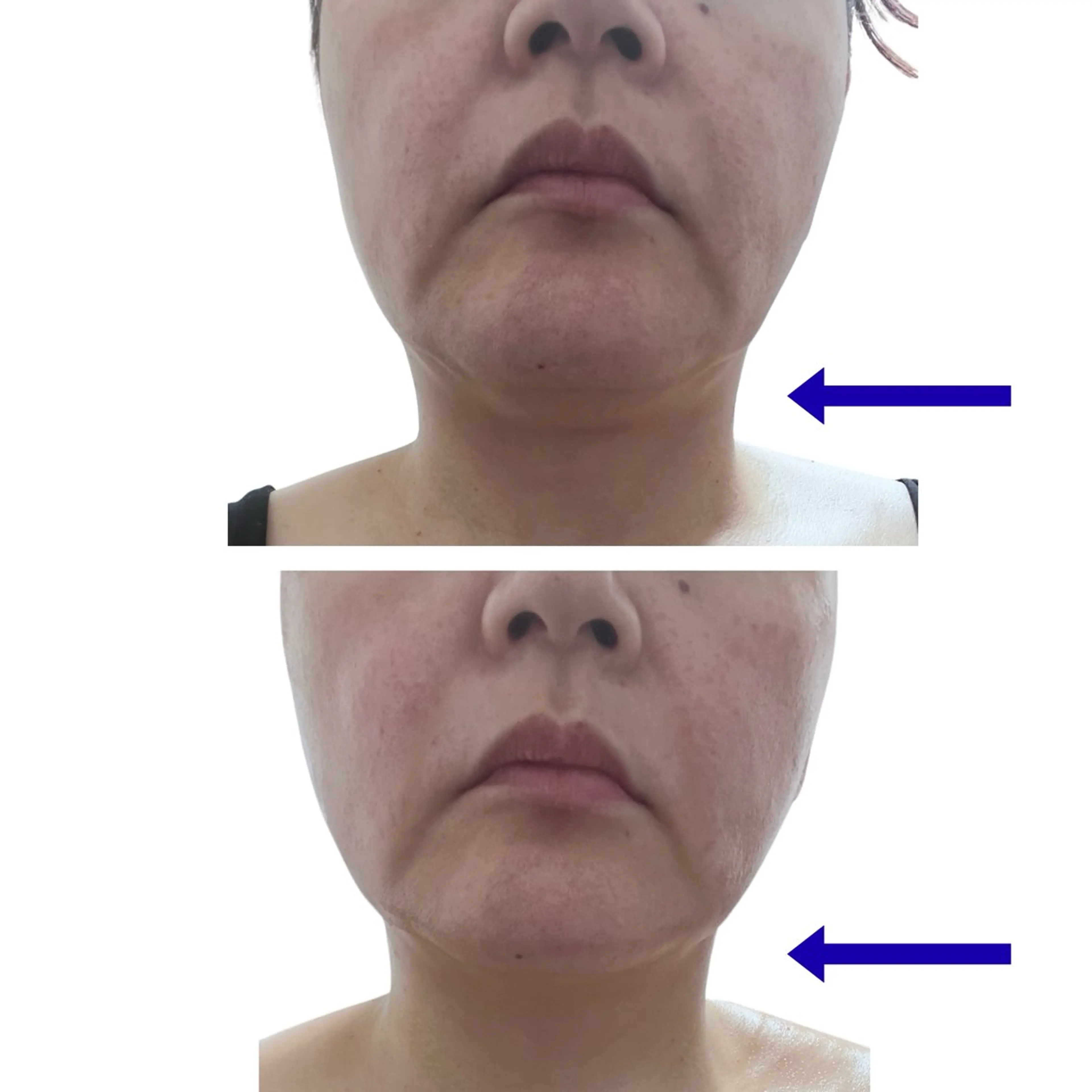 脂肪冷却/美肌改善 COCOKARAのエステ・リラクイメージ