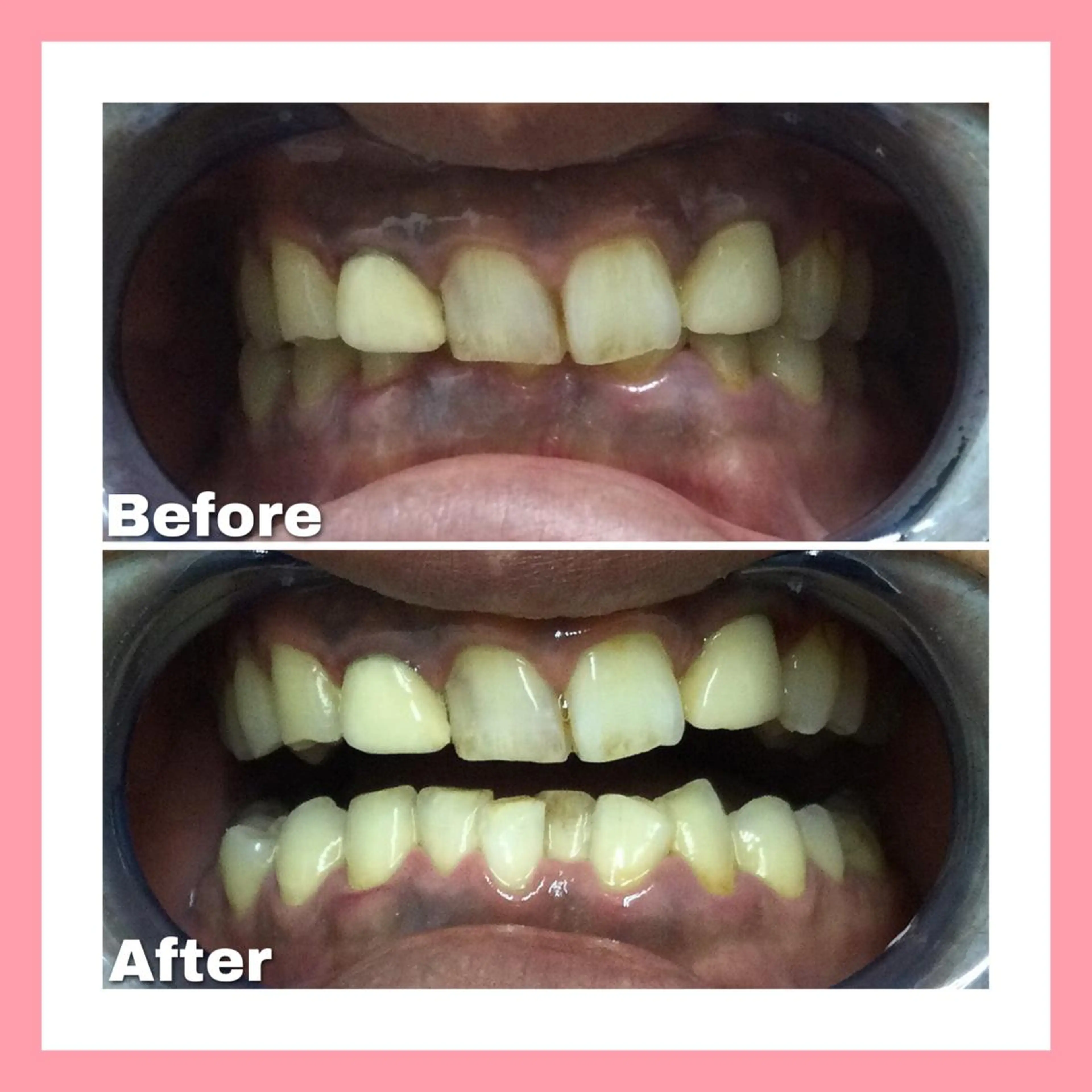 Briller 浜松のエステ・リラクイメージ