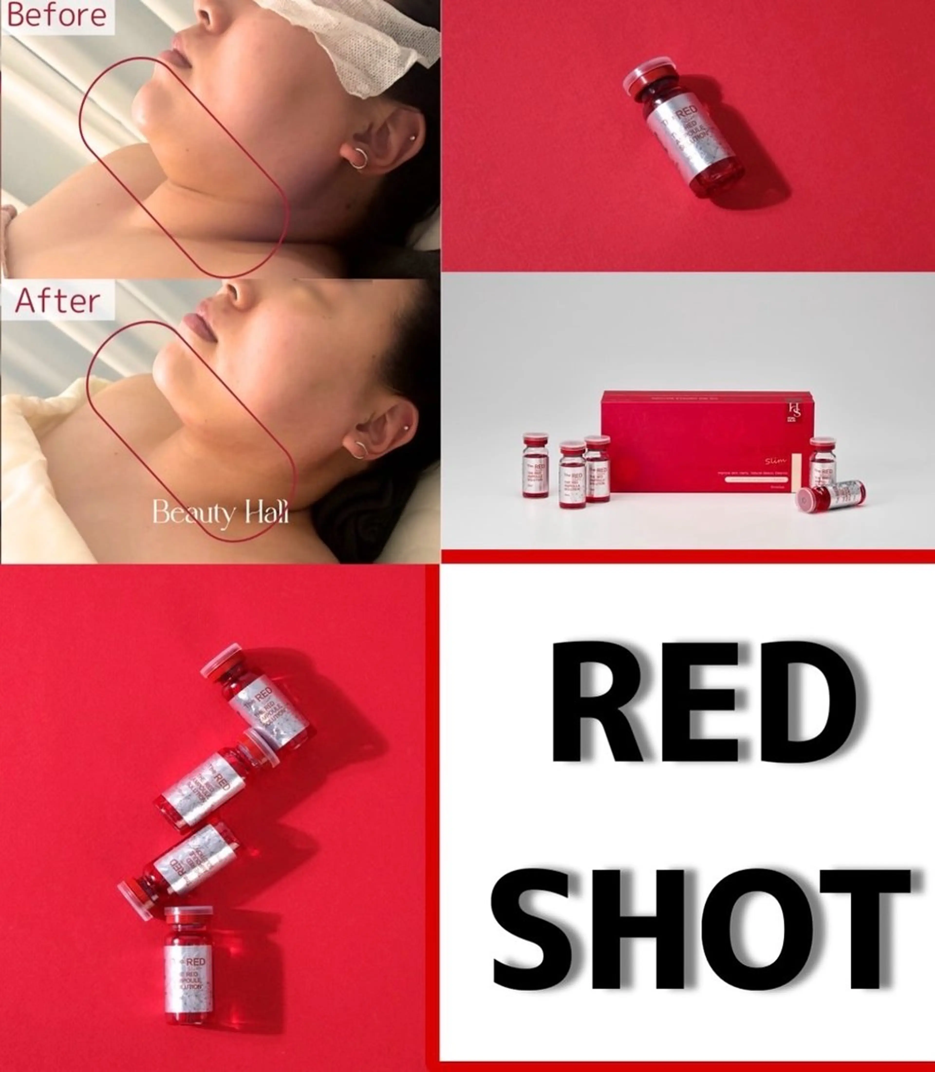 【韓国発】導入キャンペーン！お顔の引き締め★レッドショット¥13000→¥5500の写真