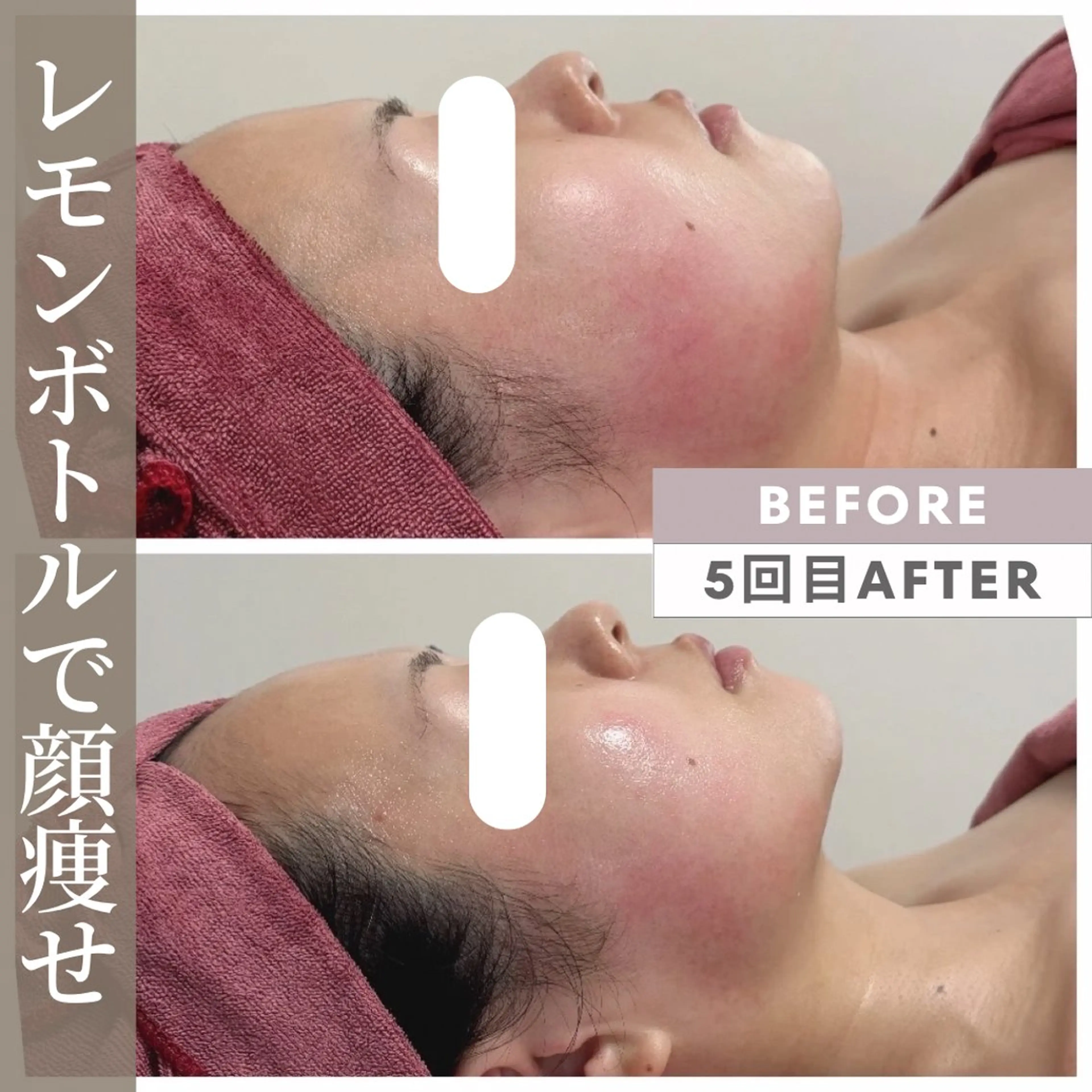 エステ リラク 小顔矯正専門店 【RED】池田のエステ・リラクイメージ