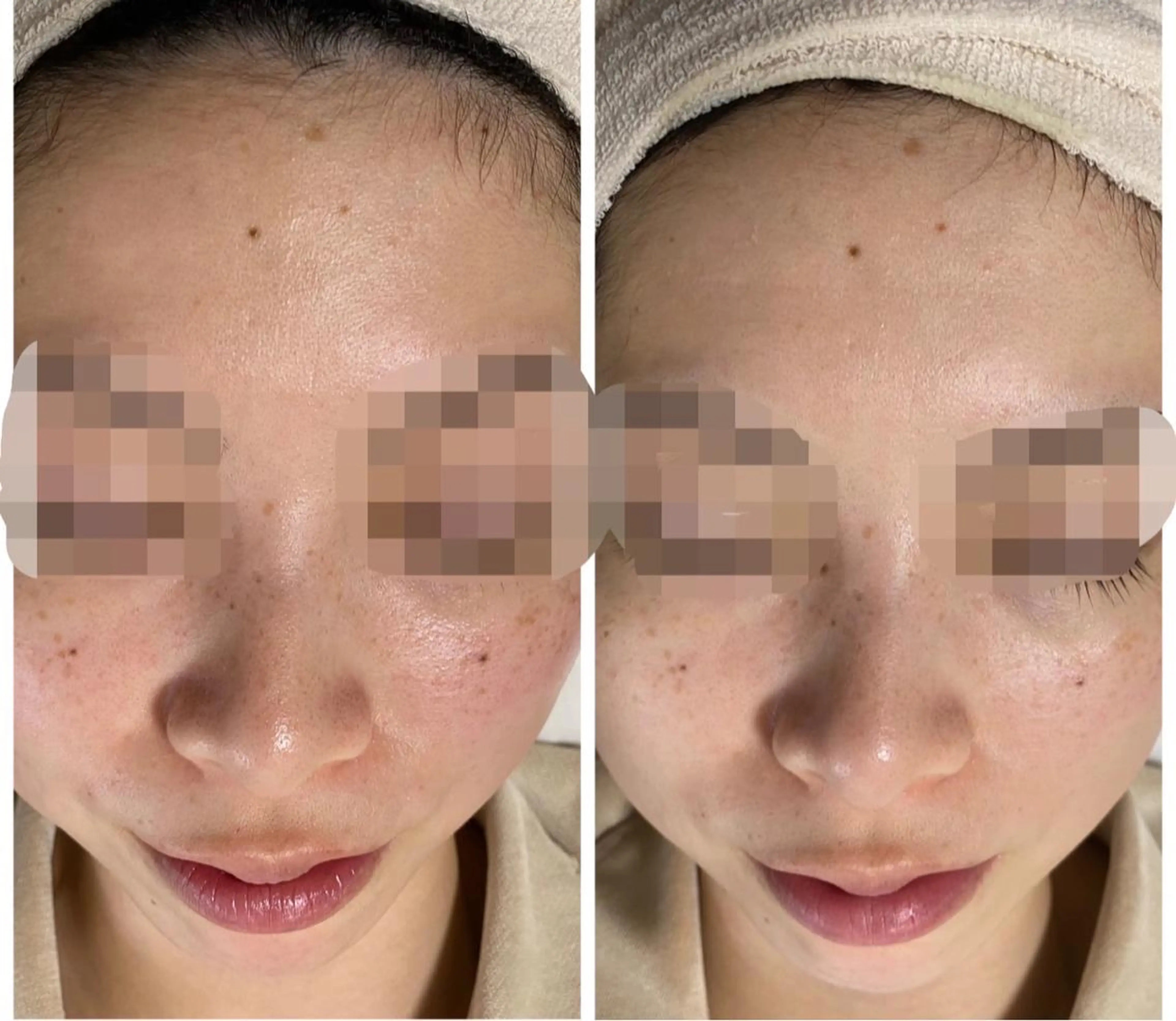 エステ De I'm トータルビューティーサロン所属・COCO beautyサロンのエステ・リラクイメージ