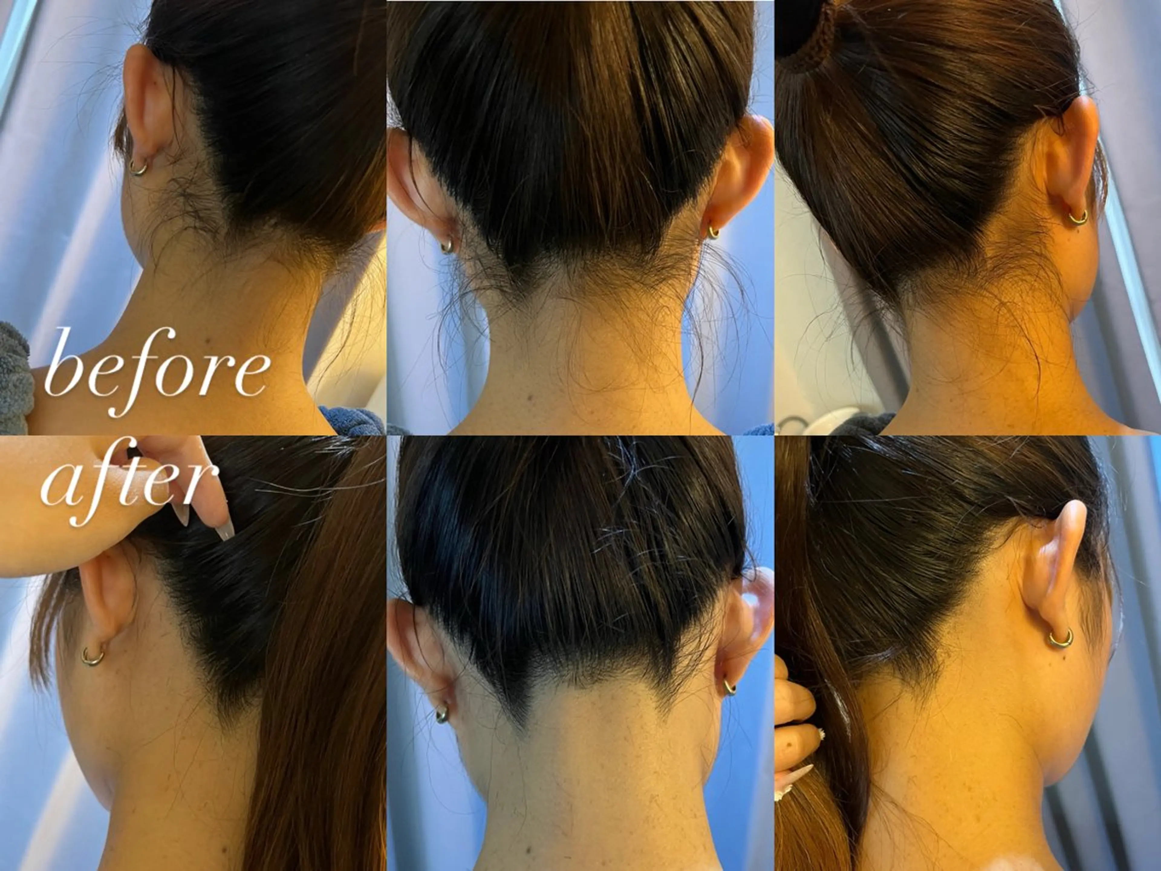 うなじ脱毛/美肌脱毛 LABELのエステ・リラクイメージ