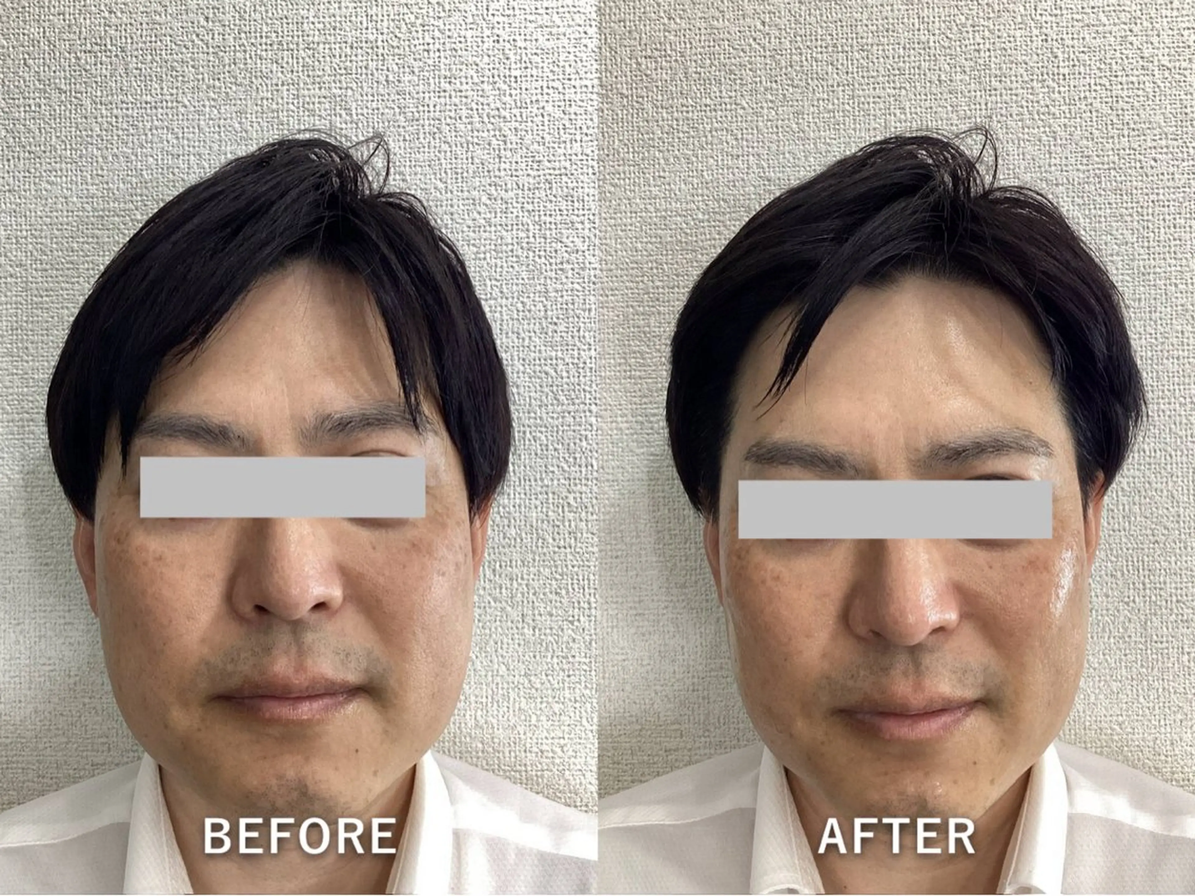 エステ Recellage所属・Recellage リセラージュのエステ・リラクイメージ