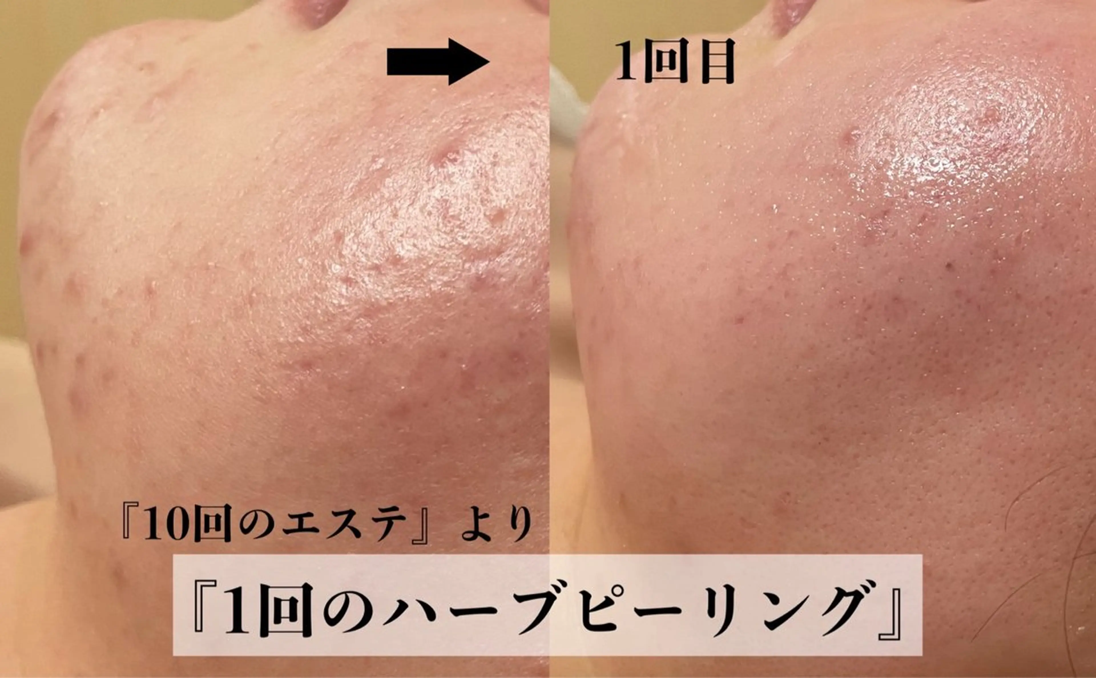 NHerb【エヌハーブ】所属・横田 汐里のエステ・リラクイメージ