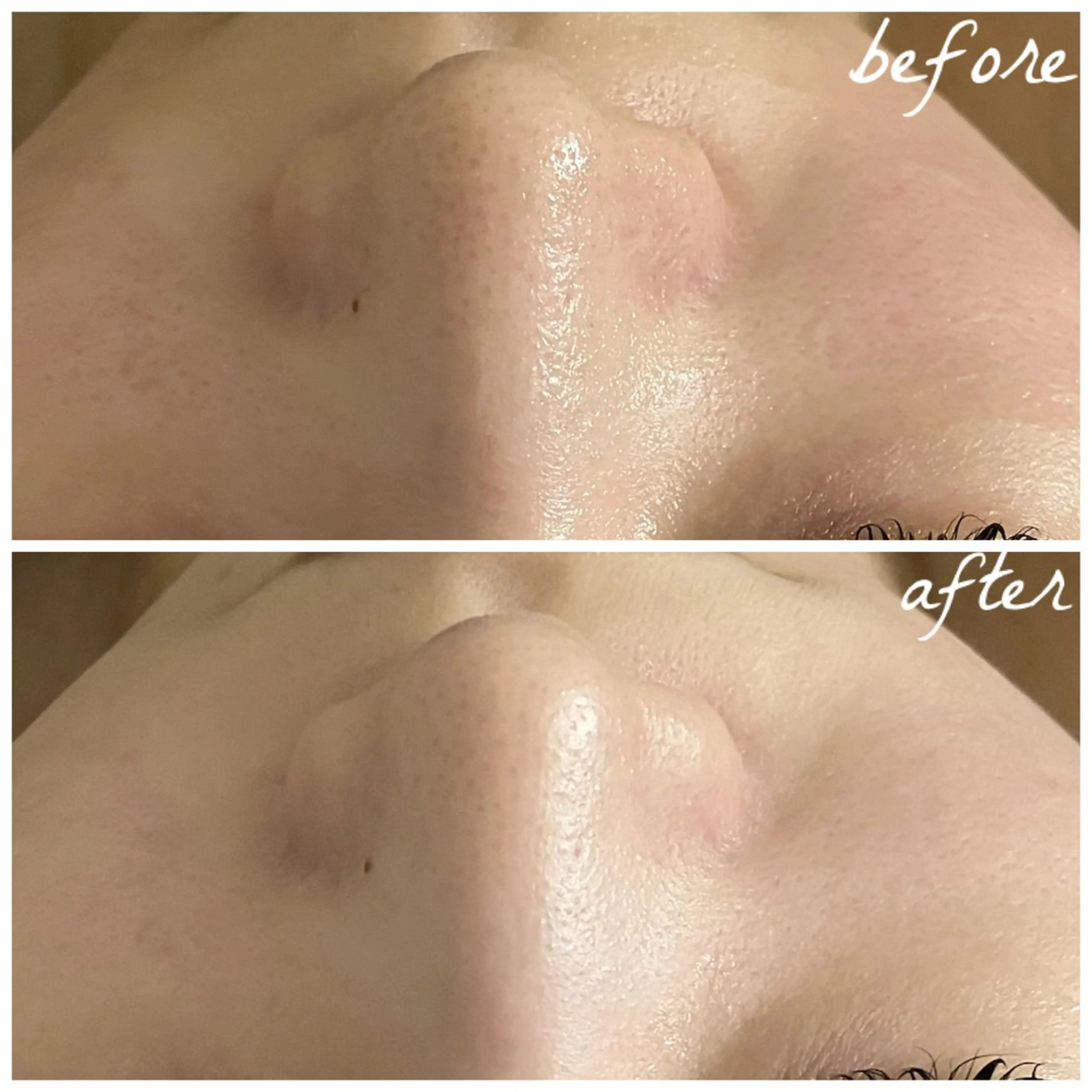 メンズ エステ メナード岐阜茜部 杉浦のエステ・リラクイメージ