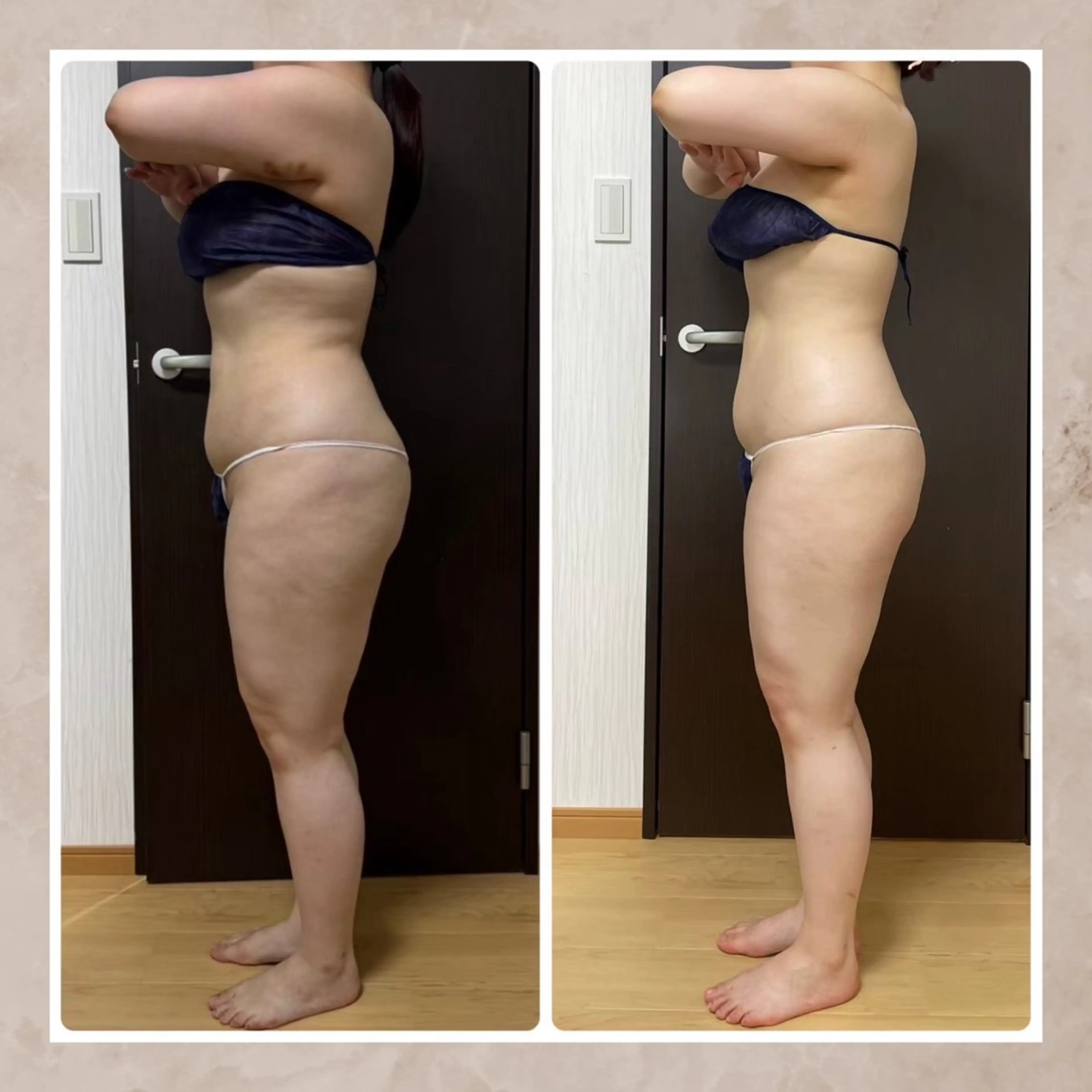 Total Beauty Salon Vi's CLUB by BINEL所属・Vi's CLUB KOTONOのエステ・リラクイメージ