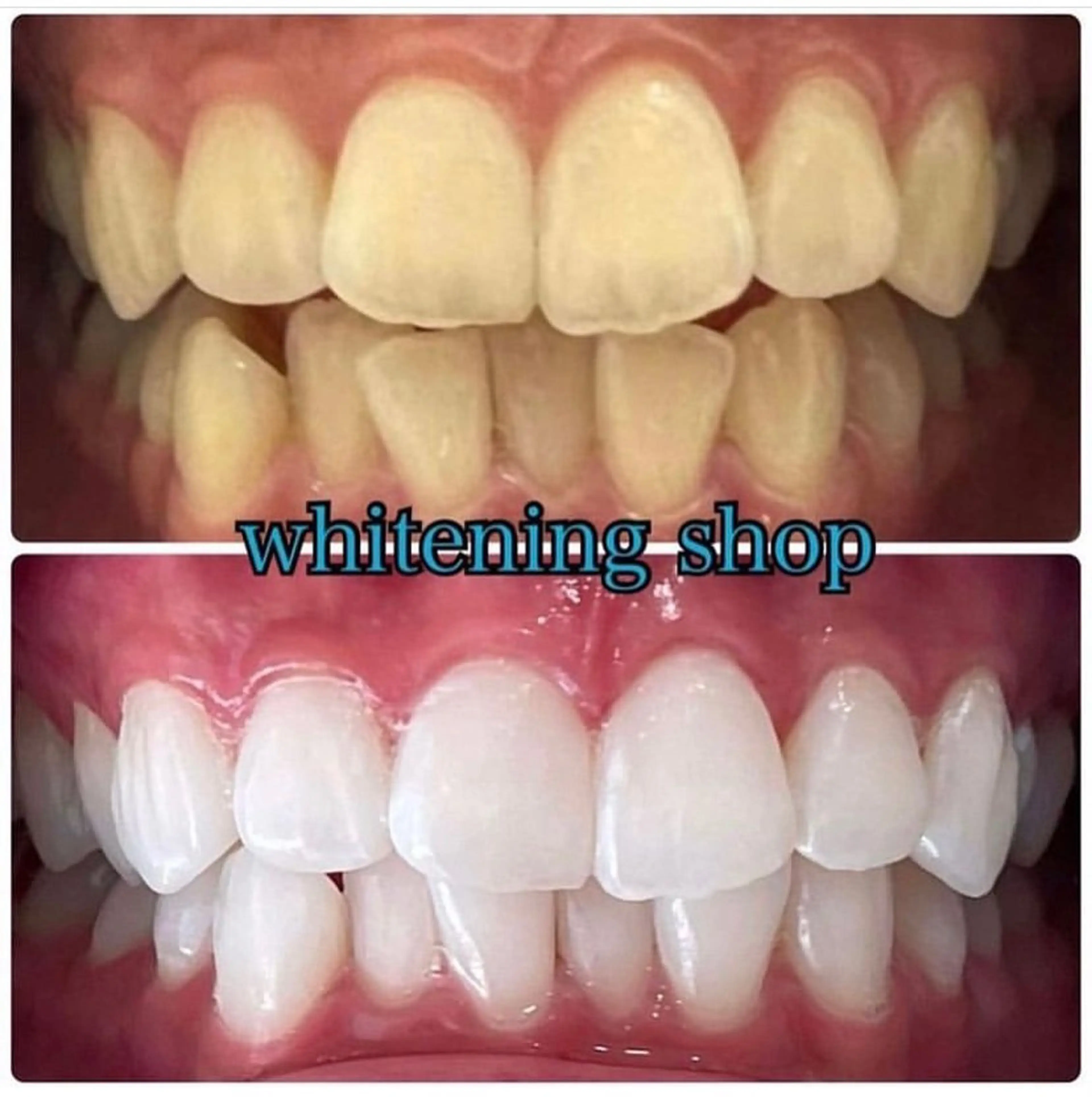 エステ リラク ホワイトニング ショップ吉祥寺店のエステ・リラクイメージ