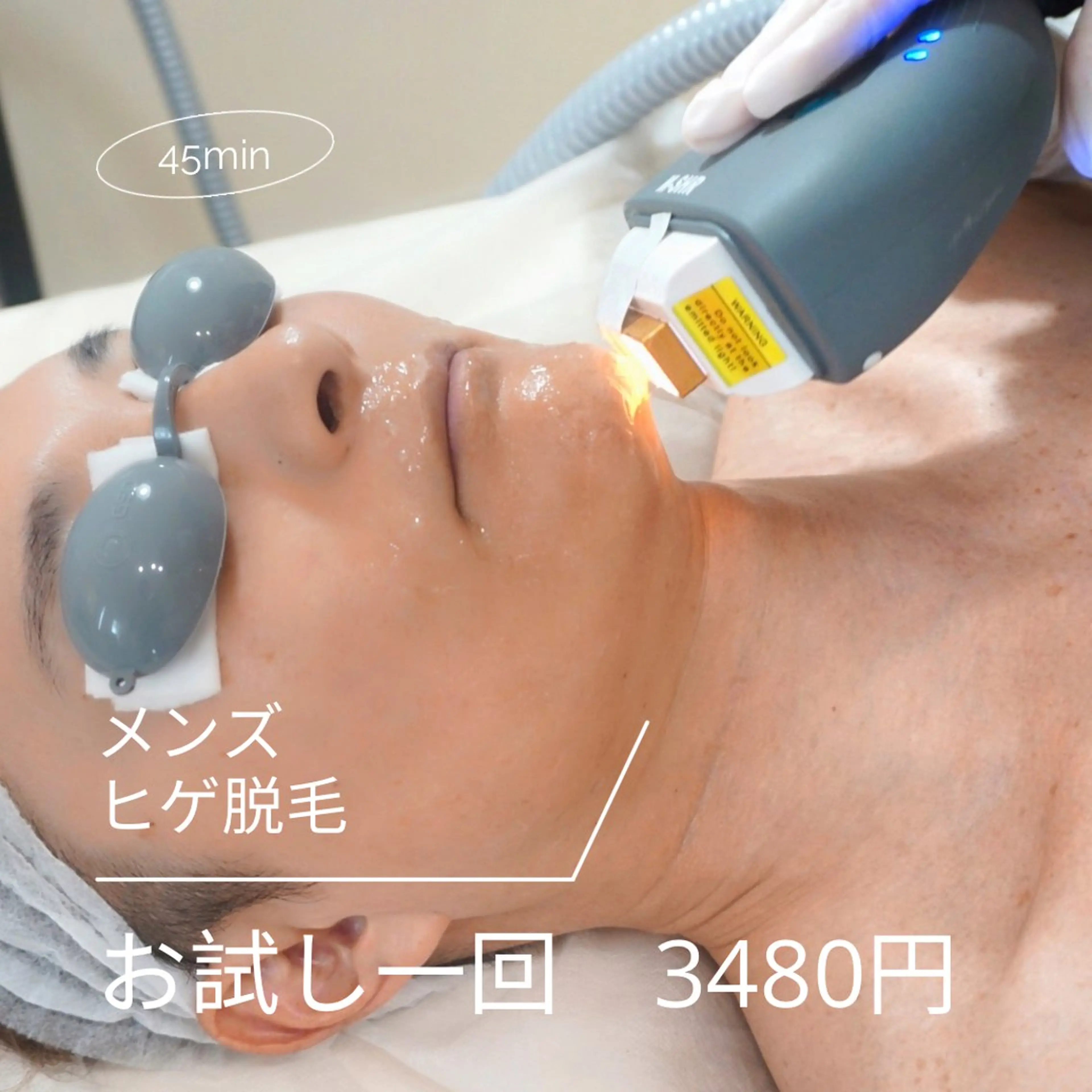 メンズヒゲ脱毛の写真