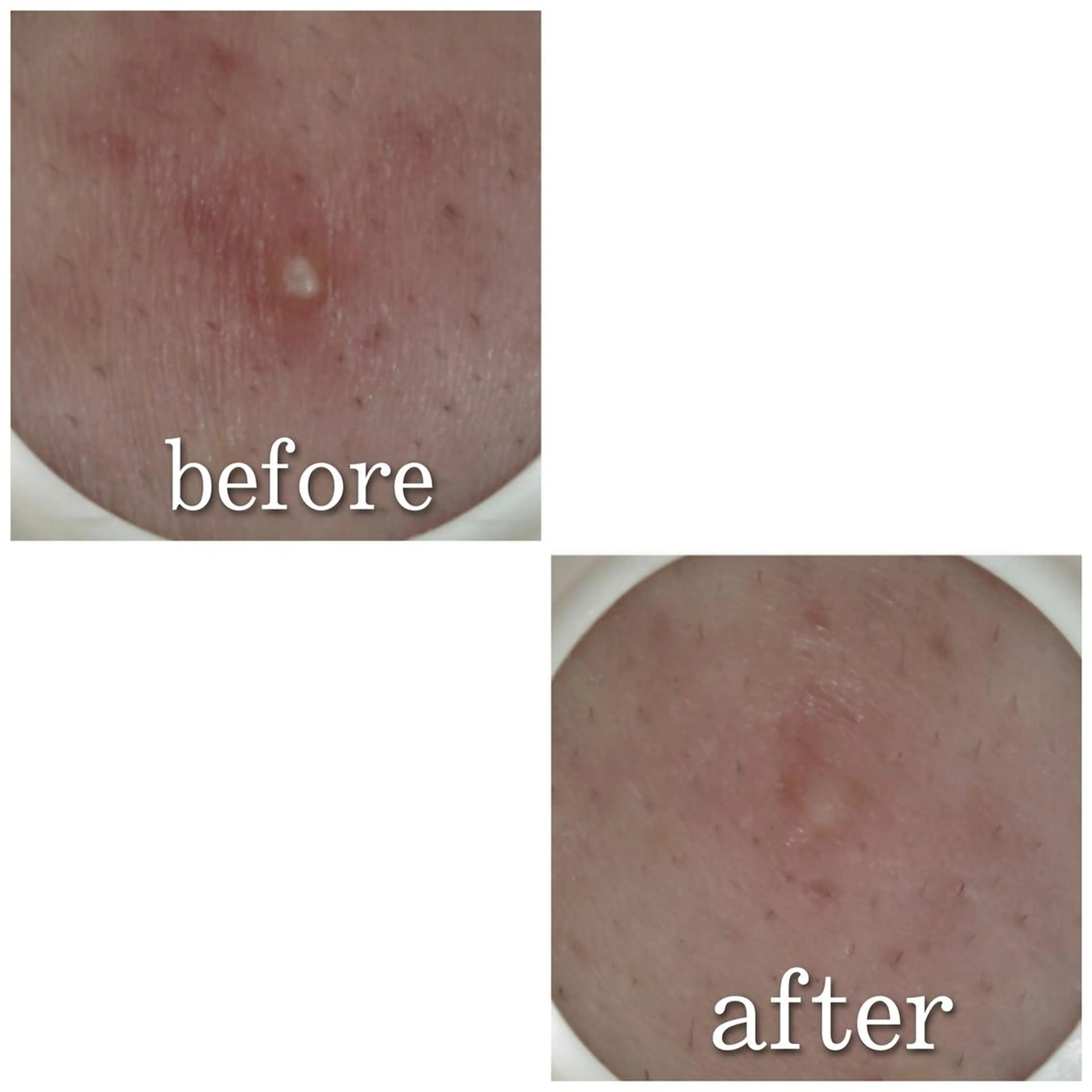 ショート カラー パーマ ヘアアレンジ メンズ キッズ ネイル マツエク・マツパ アイブロウ エステ リラク ニキビ特化型エステ 🍓最短で肌質改善のエステ・リラクイメージ