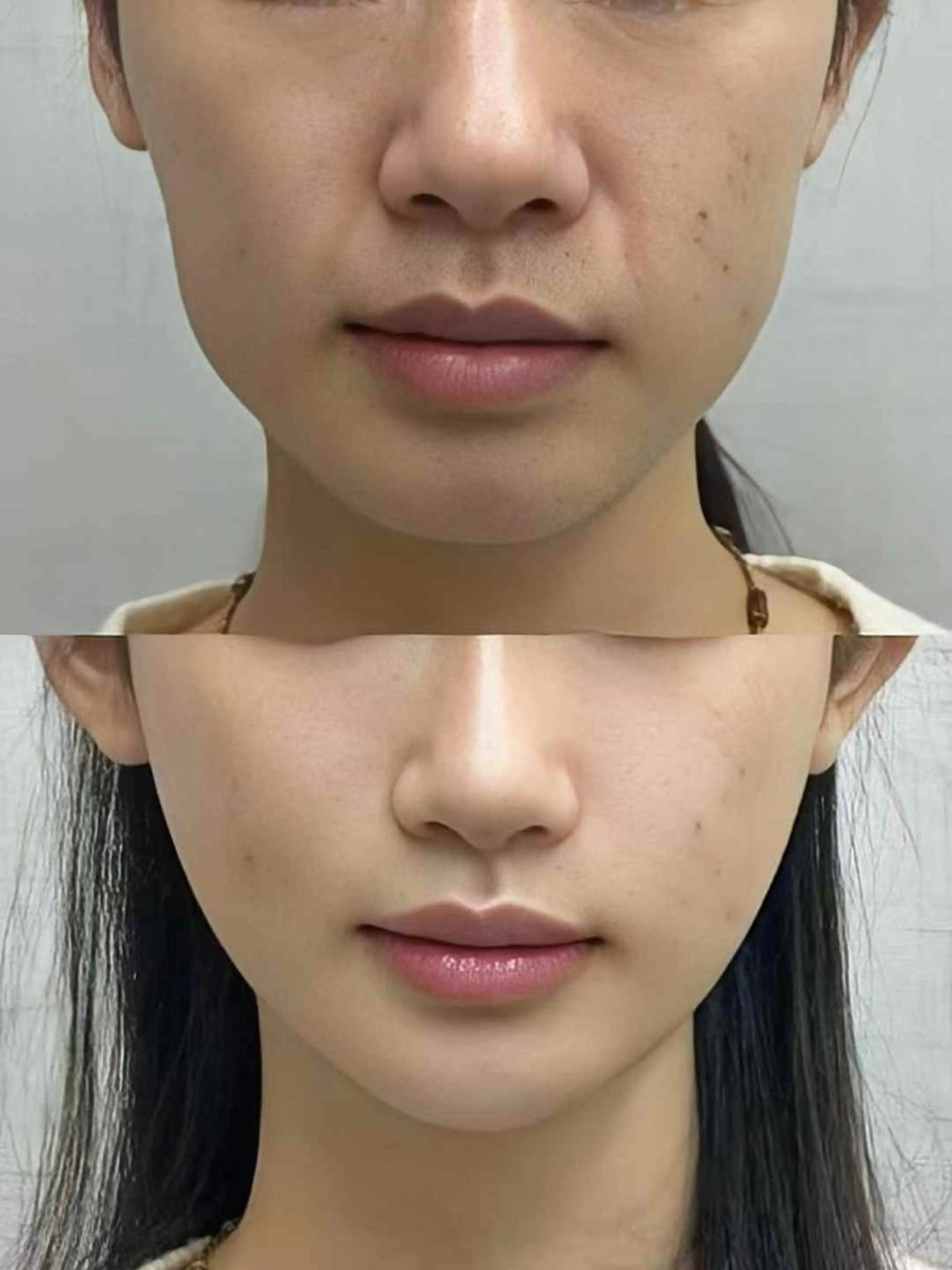 マツエク・マツパ エステ aliaハイフ&水光ジェットサロン所属・aliaハーブ水光店 エステティシャン募集のエステ・リラクイメージ