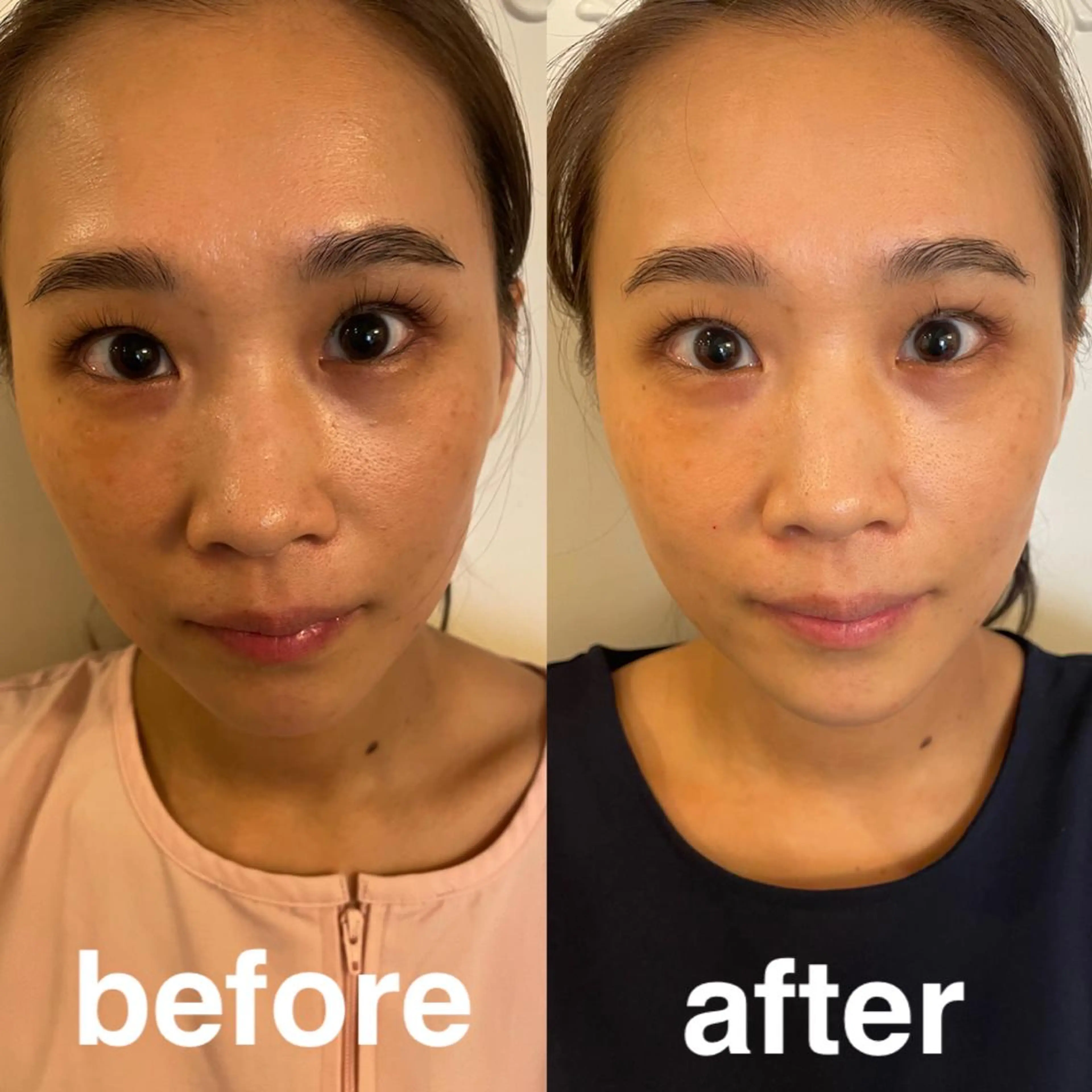 エステ リラク 美容鍼灸サロン mahoroba院長のエステ・リラクイメージ