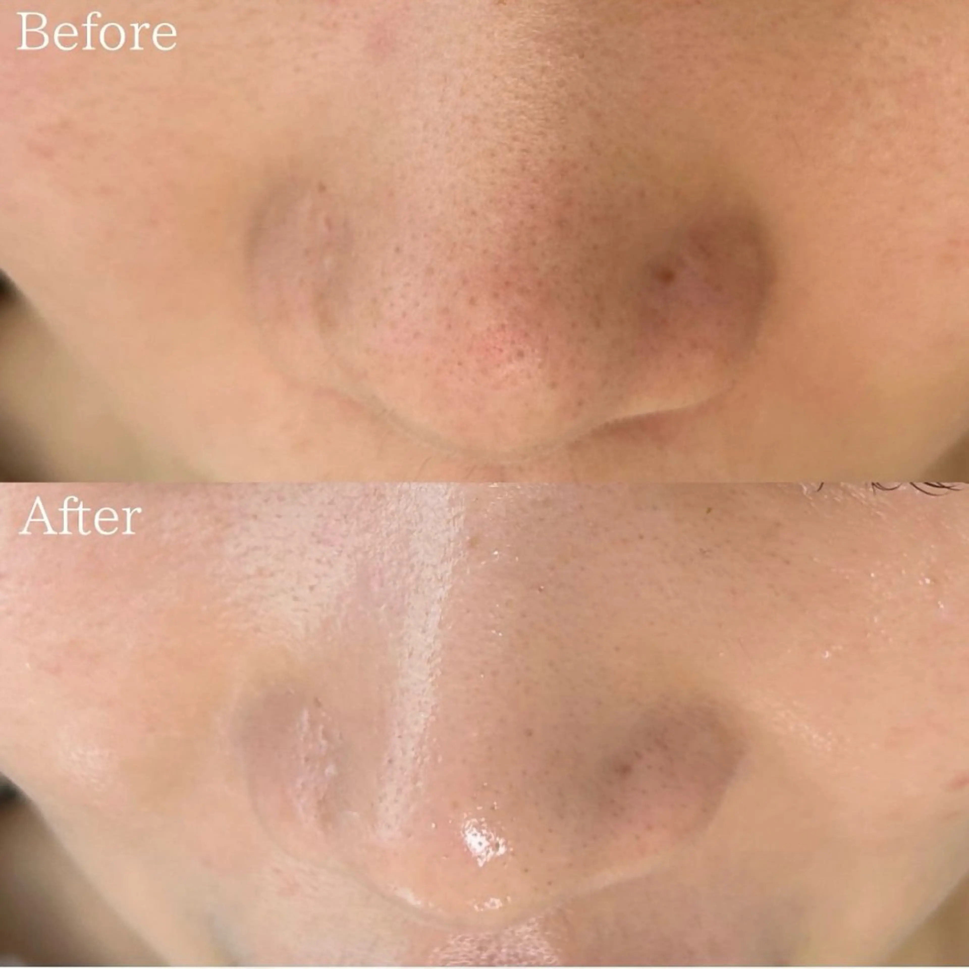 silo 結果重視の美肌サロンのエステ・リラクイメージ