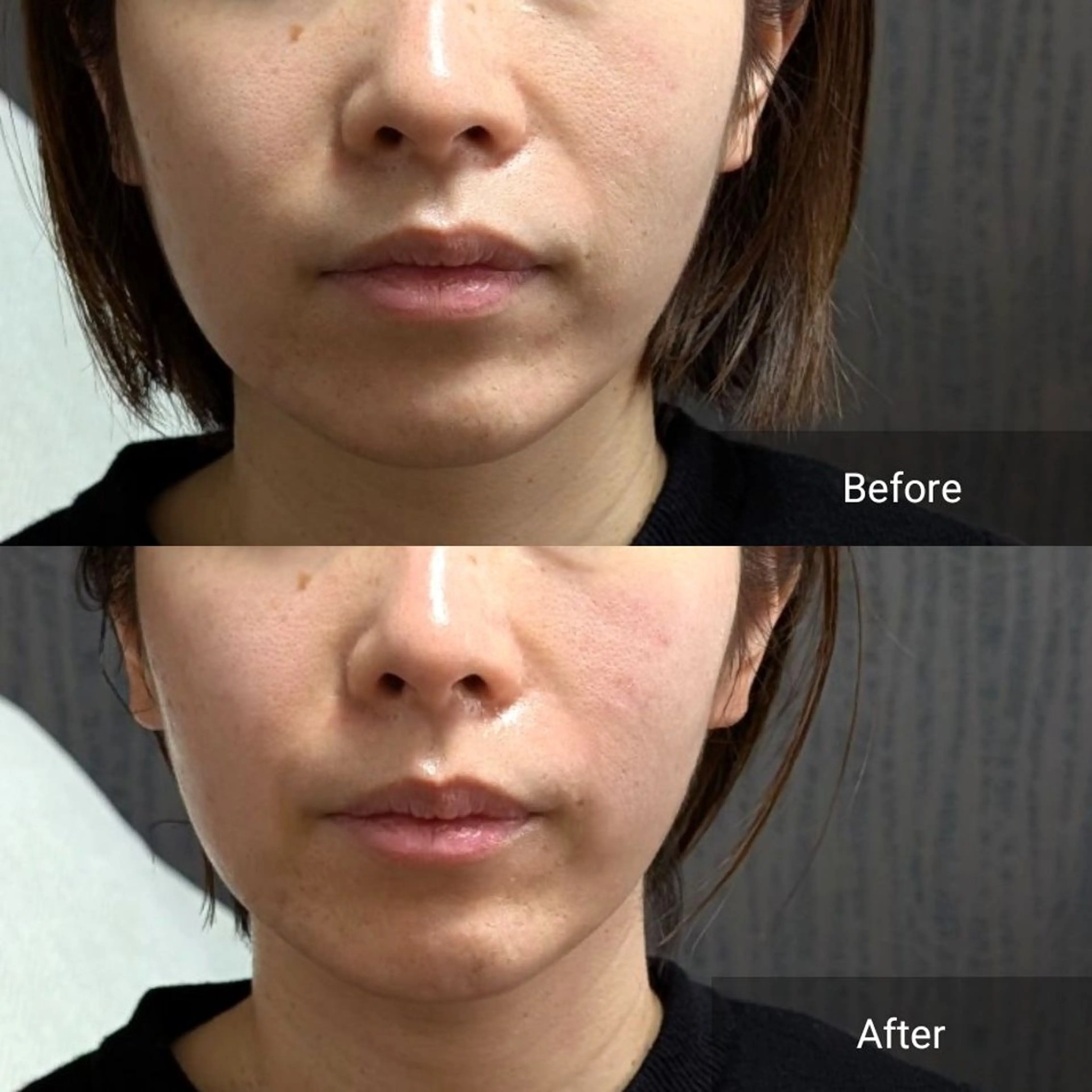 エステ nail RiRi アトレナチュラのエステ・リラクイメージ