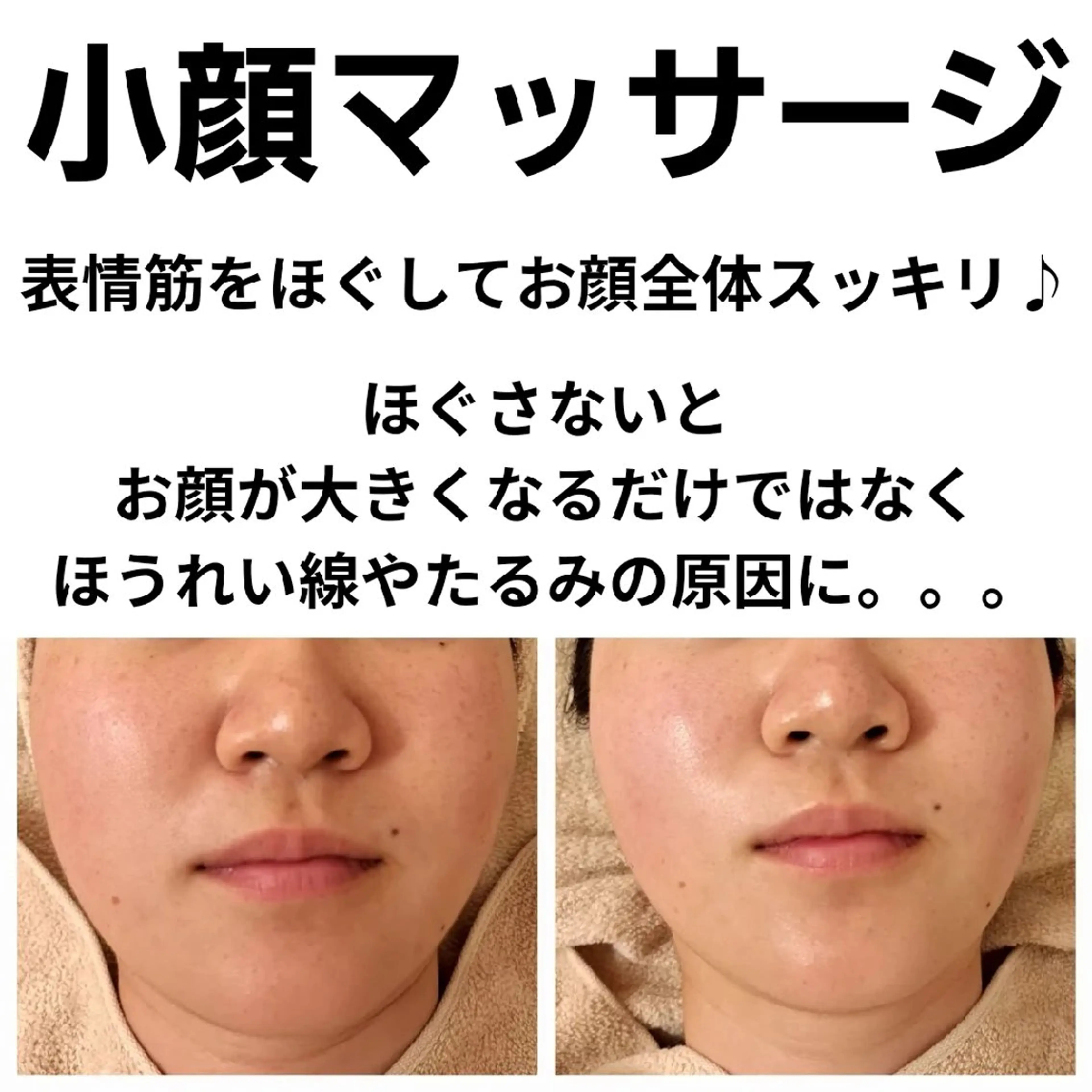 エステ フェイシャル専門サロ ン　ERINのエステ・リラクイメージ