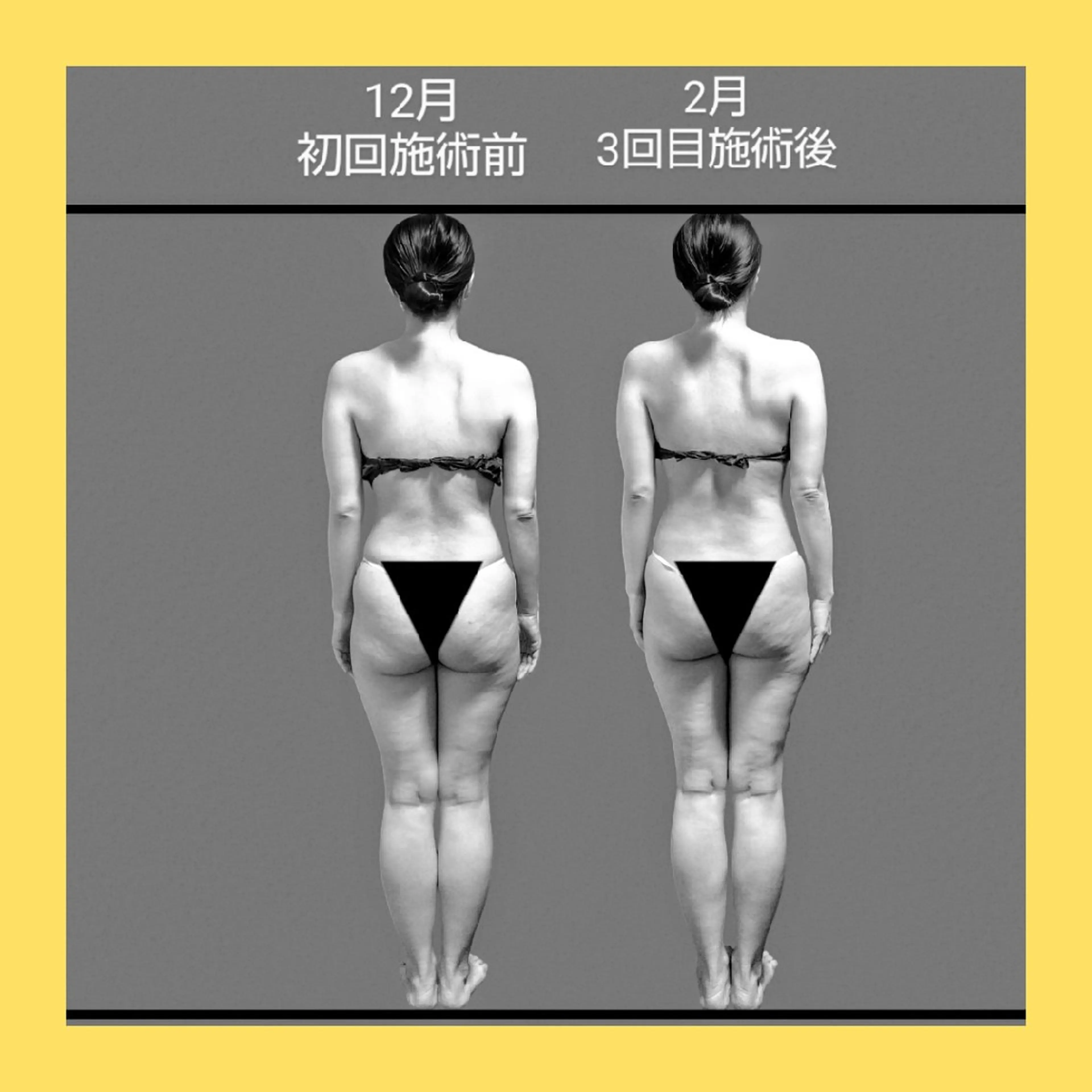 エステ リラク Ichi Fluorite Body所属・Ichi Fluo rite Bodyのエステ・リラクイメージ