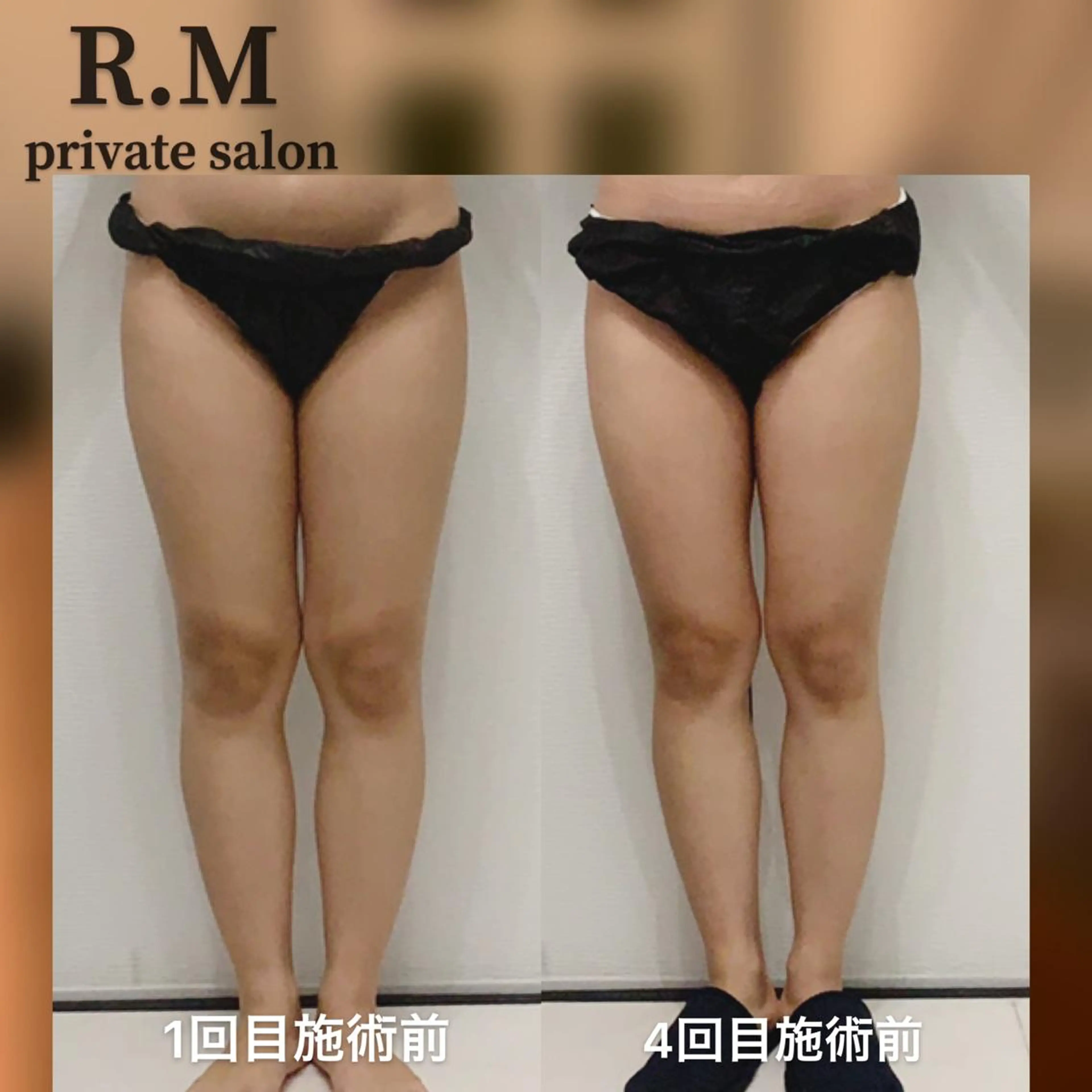 エステ リラク R.M所属・プライベートサロン R.Mのエステ・リラクイメージ