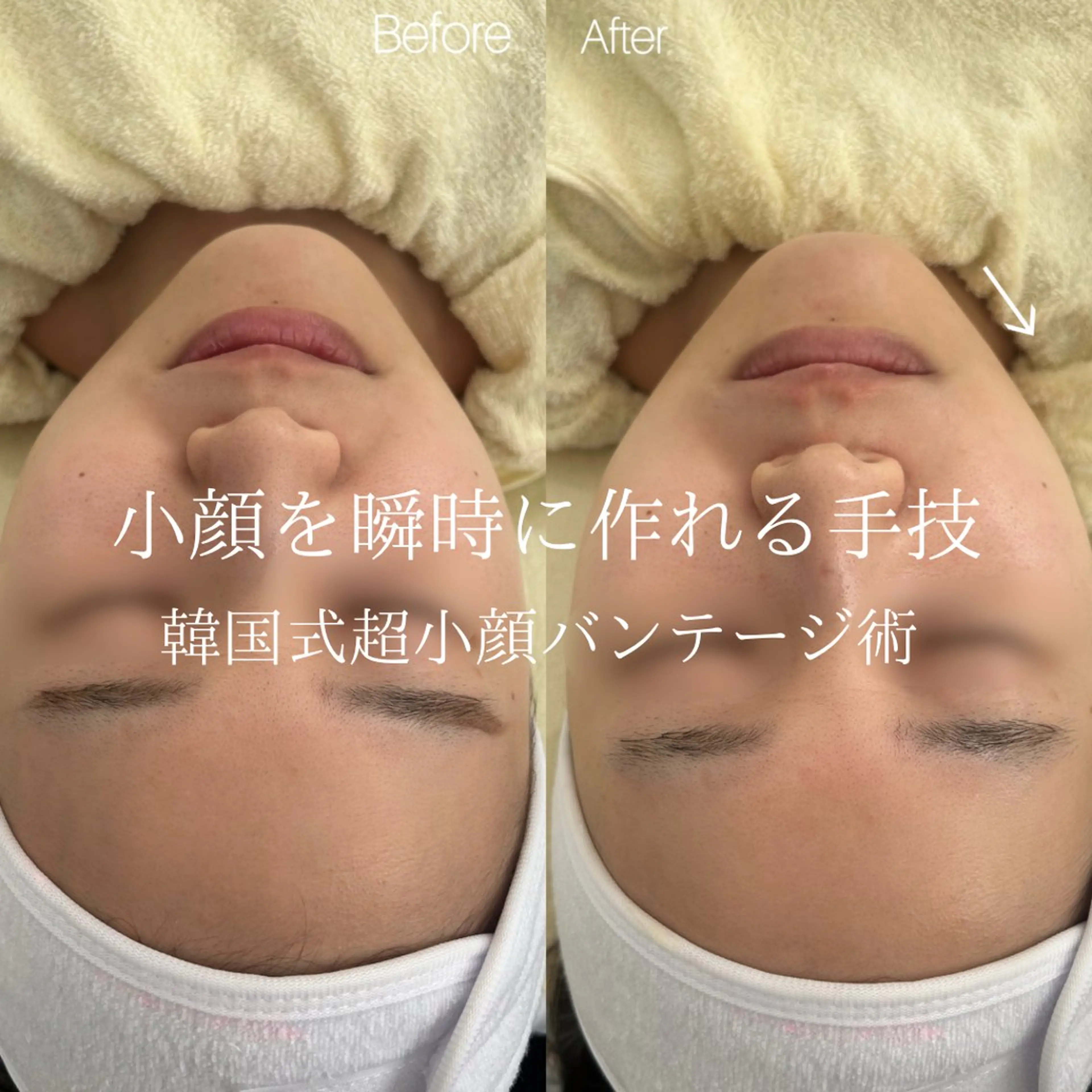 〈etre〉トータルビューティーサロン所属・etre - 韓国肌管理 -のエステ・リラクイメージ