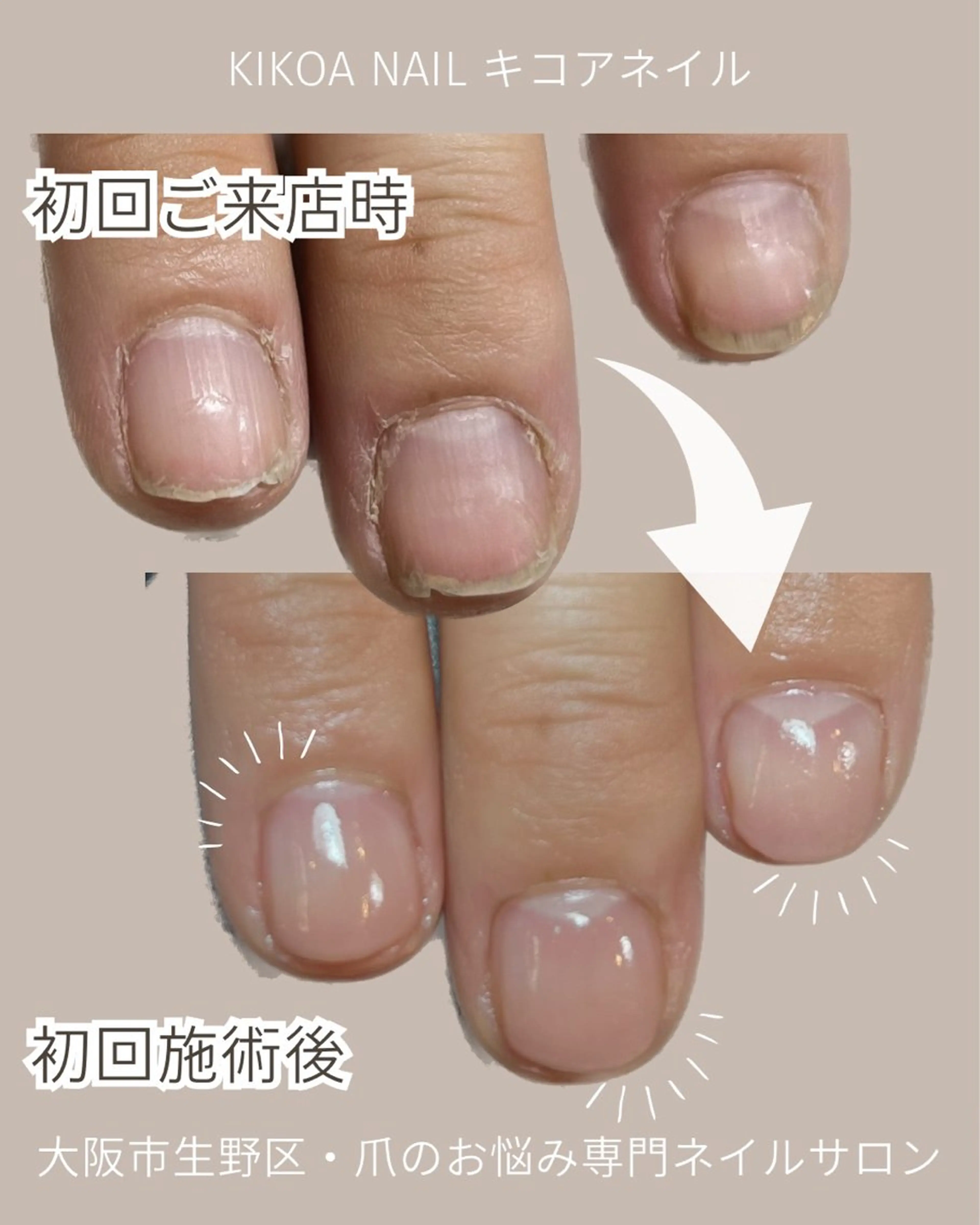 ネイル KIKOA NAIL キコアネイルのネイルデザイン