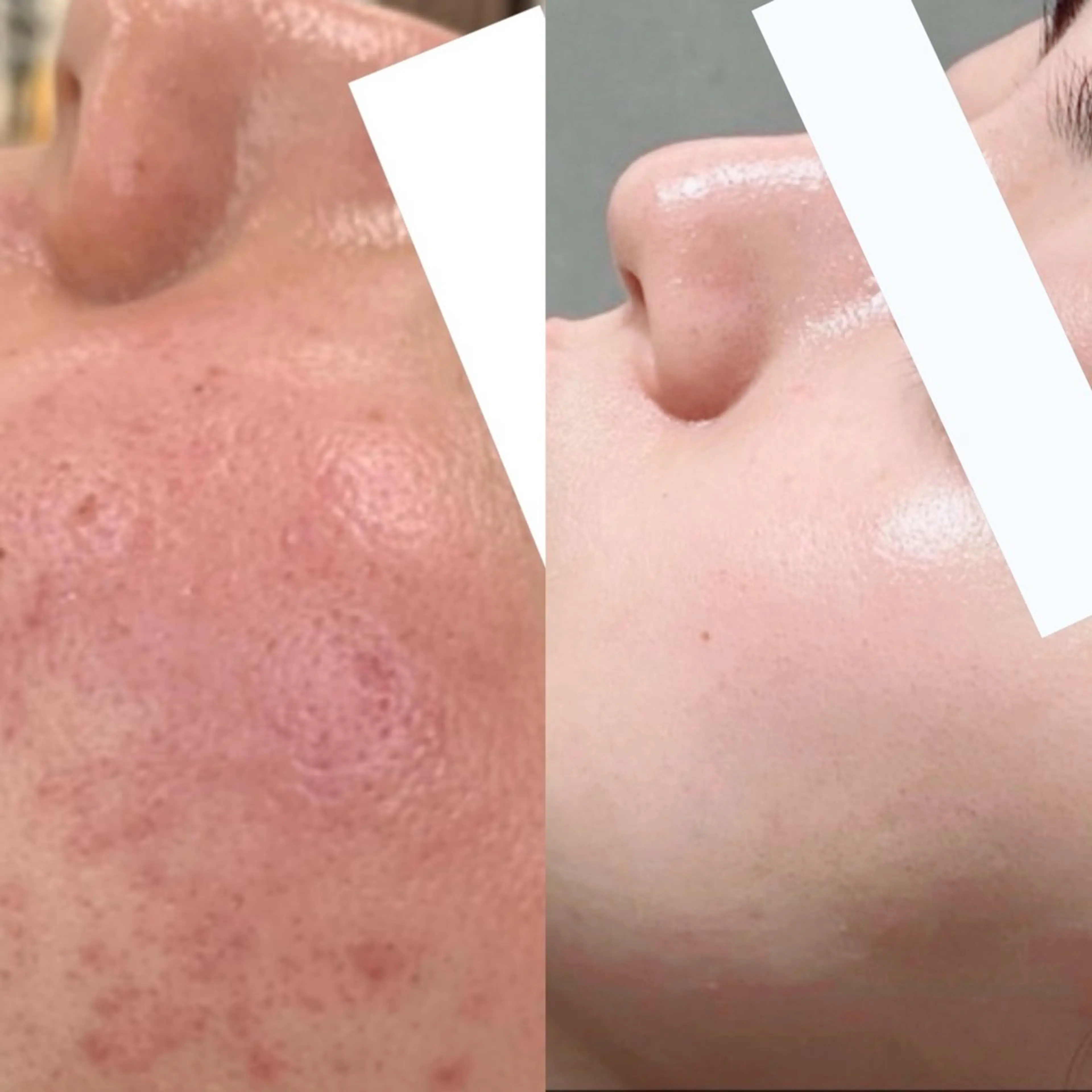 、 、‪‪のエステ・リラクイメージ