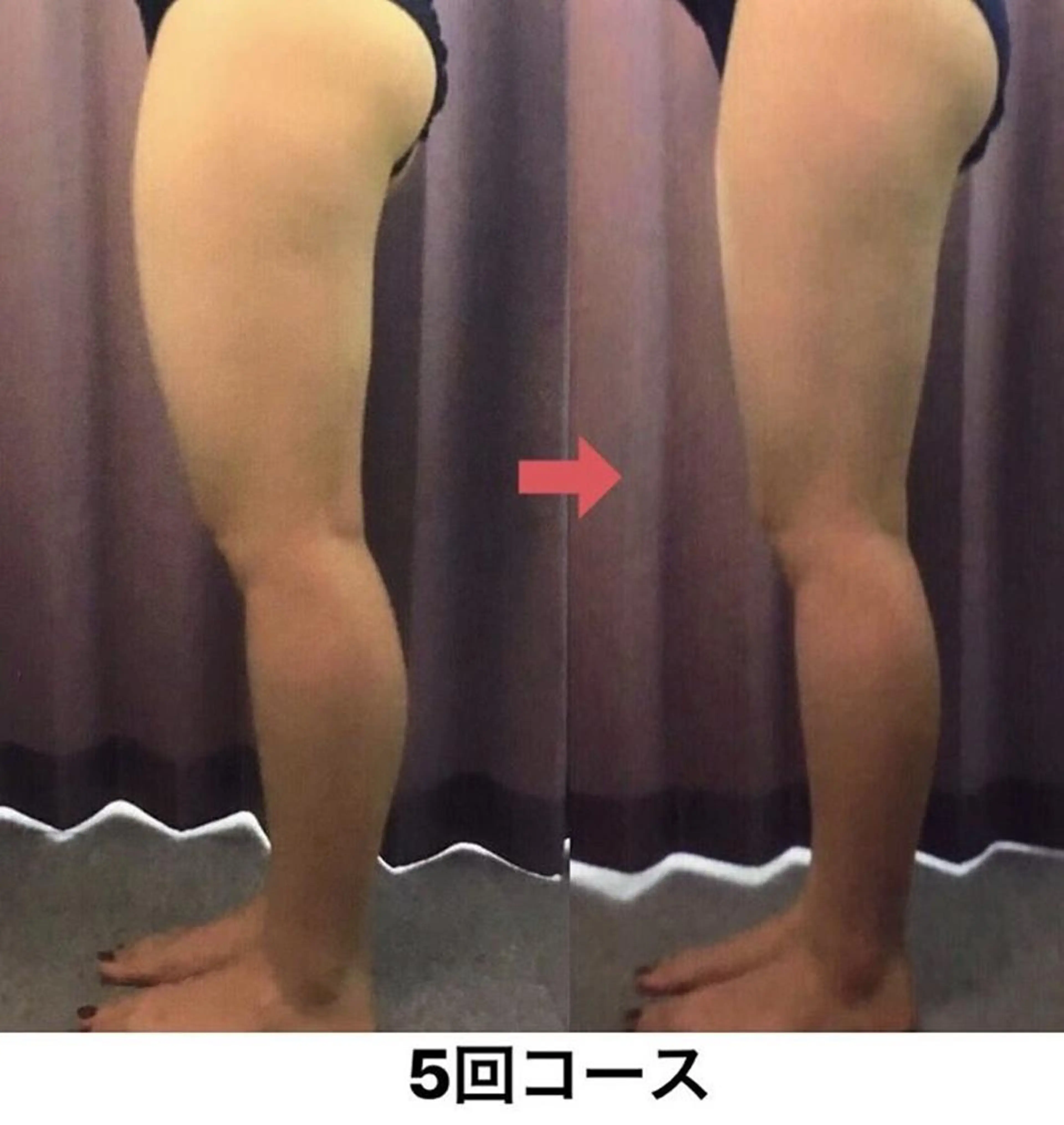 横浜エステサロン R-ing　リングのエステ・リラクイメージ