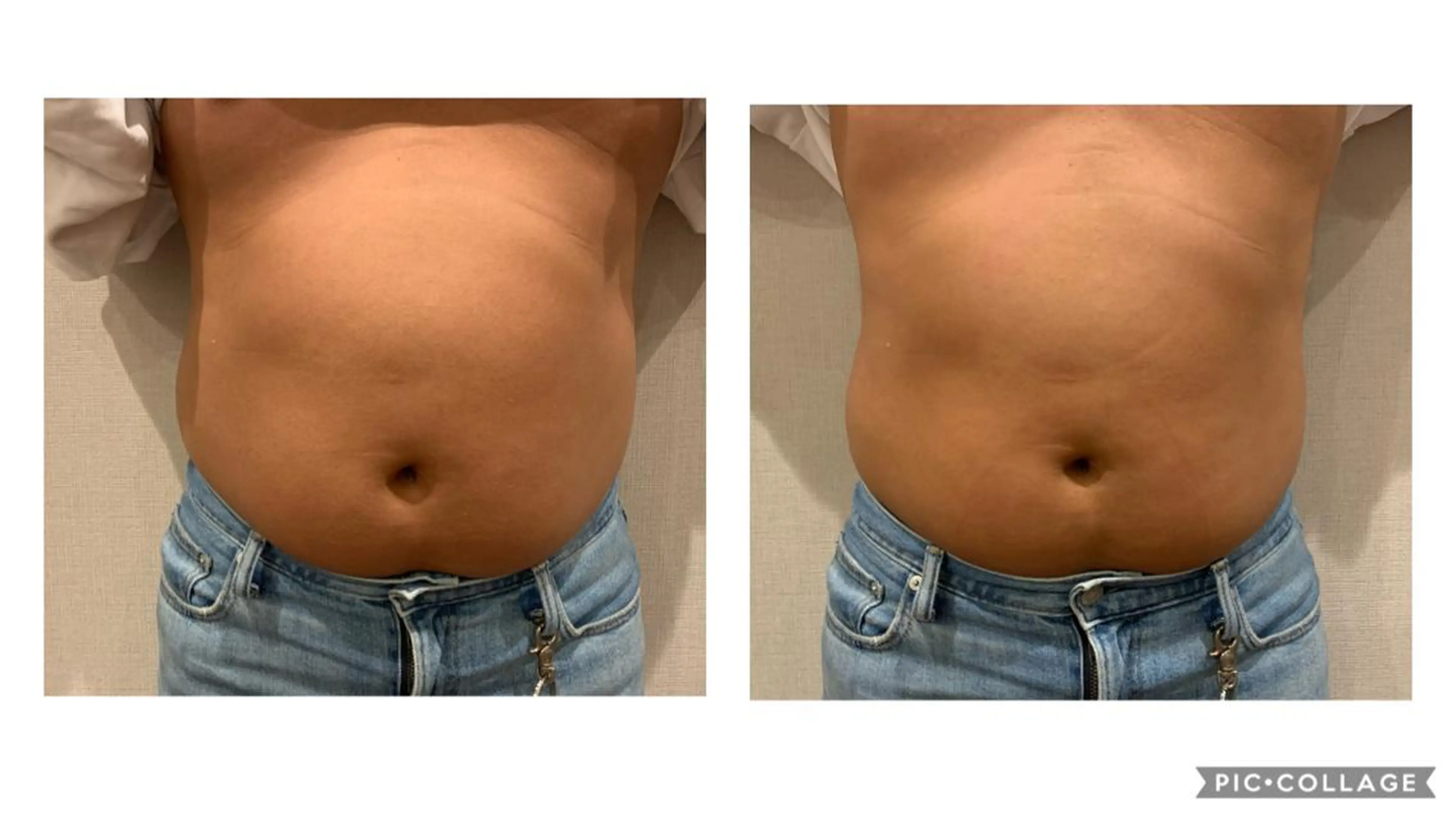 メンズ エステ リラク POLA大阪堀江店所属・POLA大阪堀江店 小顔エステのエステ・リラクイメージ