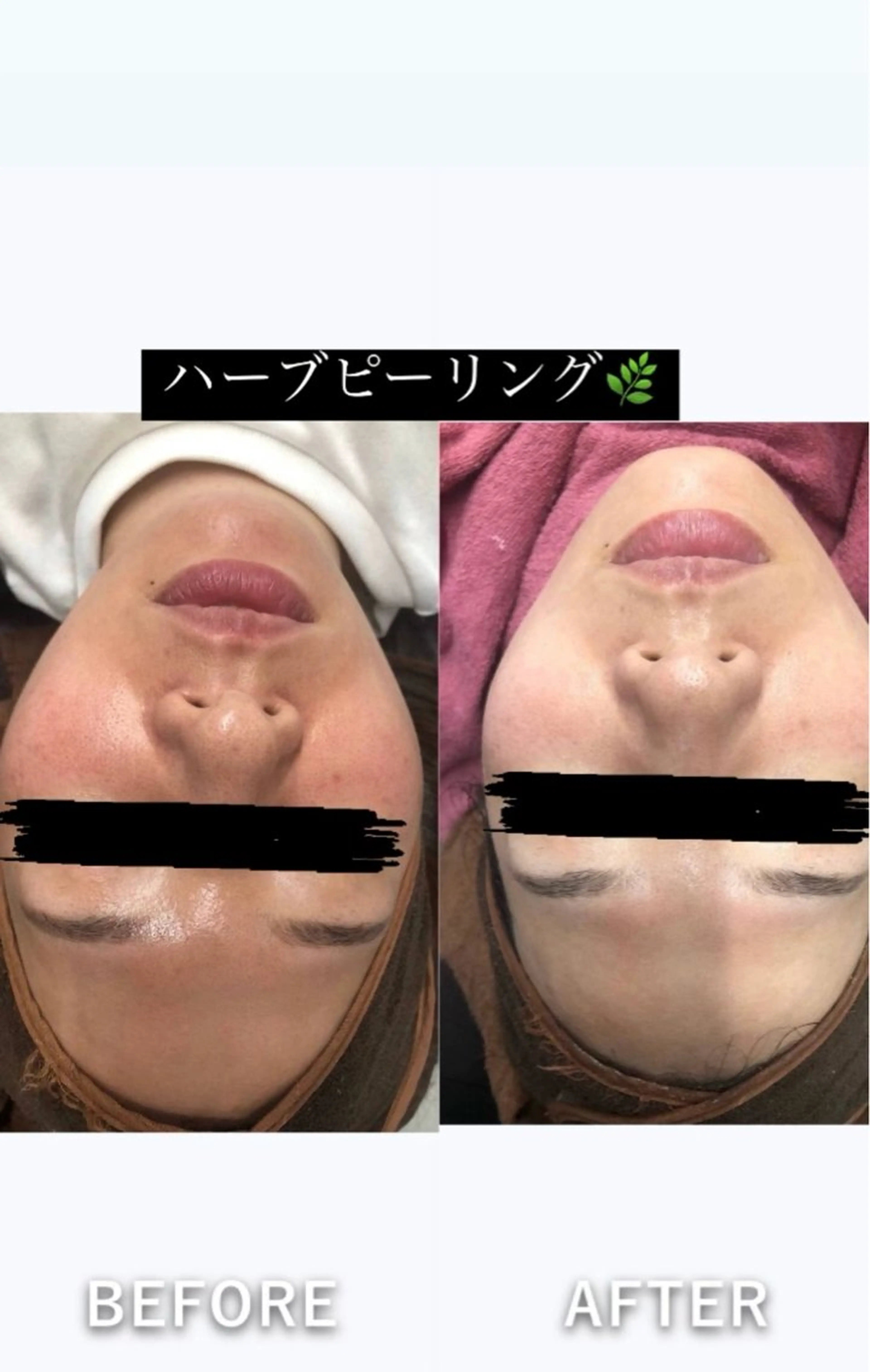 エステ 美容整体・塗る漢方・フェイシャルRechica所属・心斎橋痩身 美肌整体サロン💓のエステ・リラクイメージ