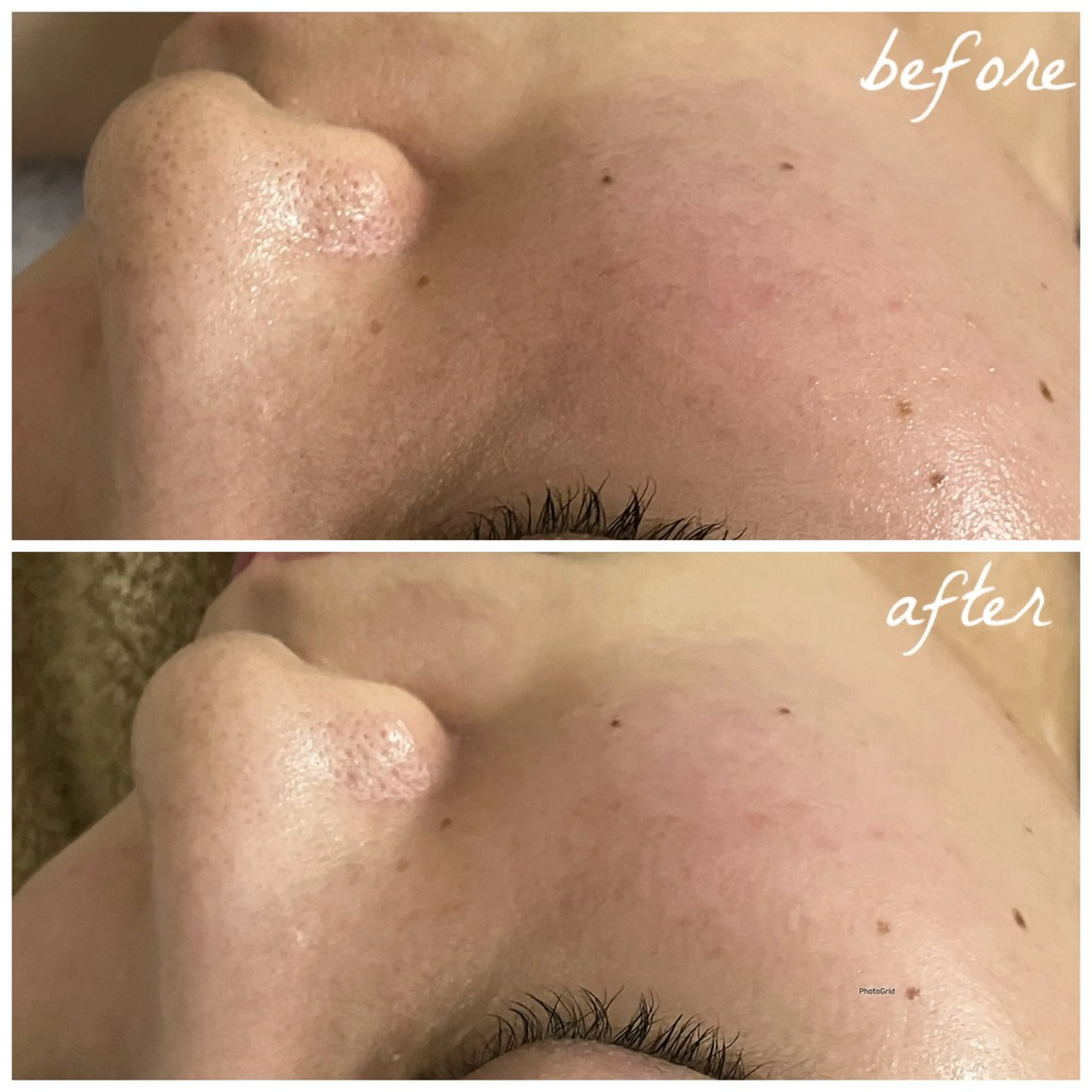 メンズ エステ メナード岐阜茜部 杉浦のエステ・リラクイメージ