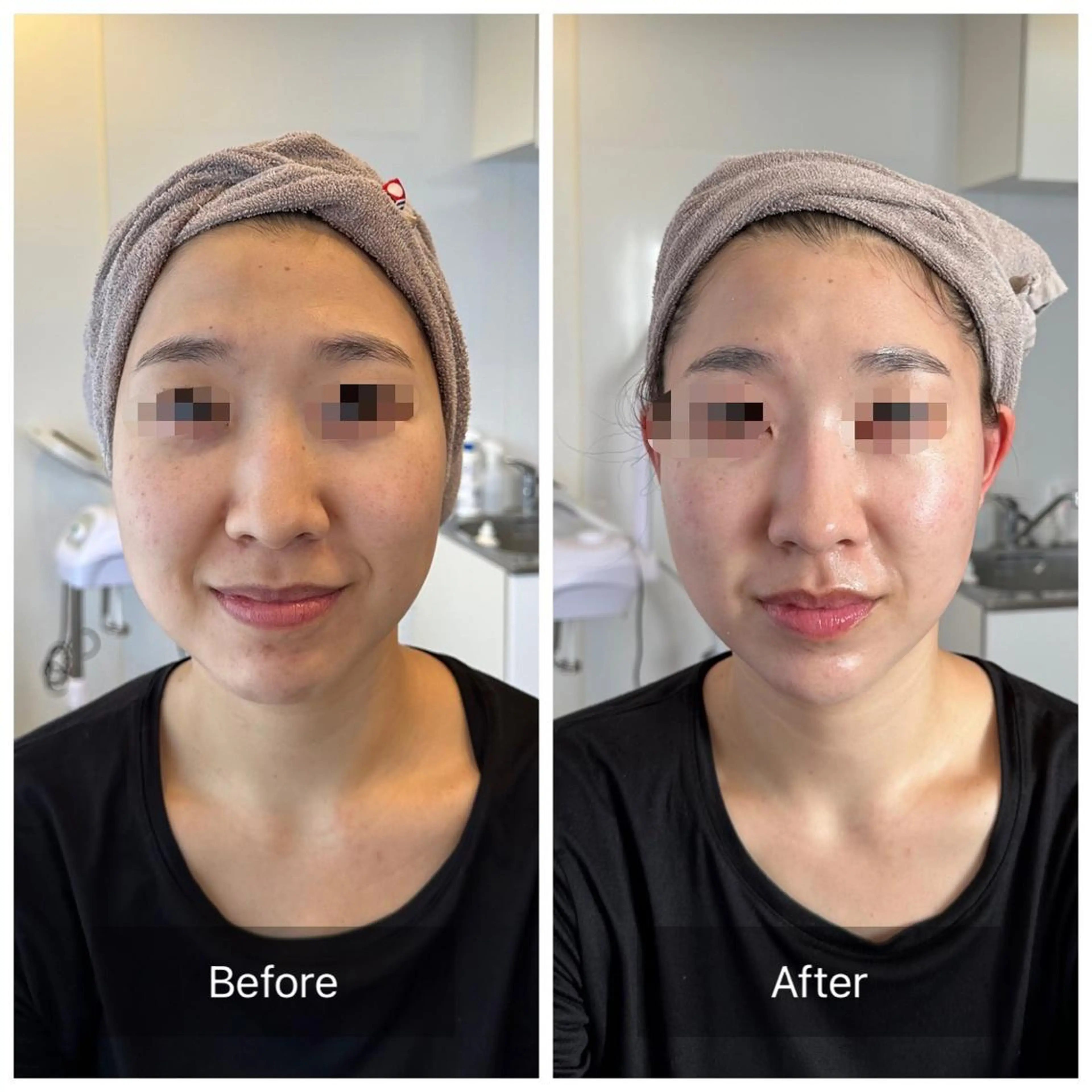 【モニター募集‼︎】剥けない‼️リアボーテハーブ🌿トリートメント🌿料金はお問い合わせくださいませ。の写真