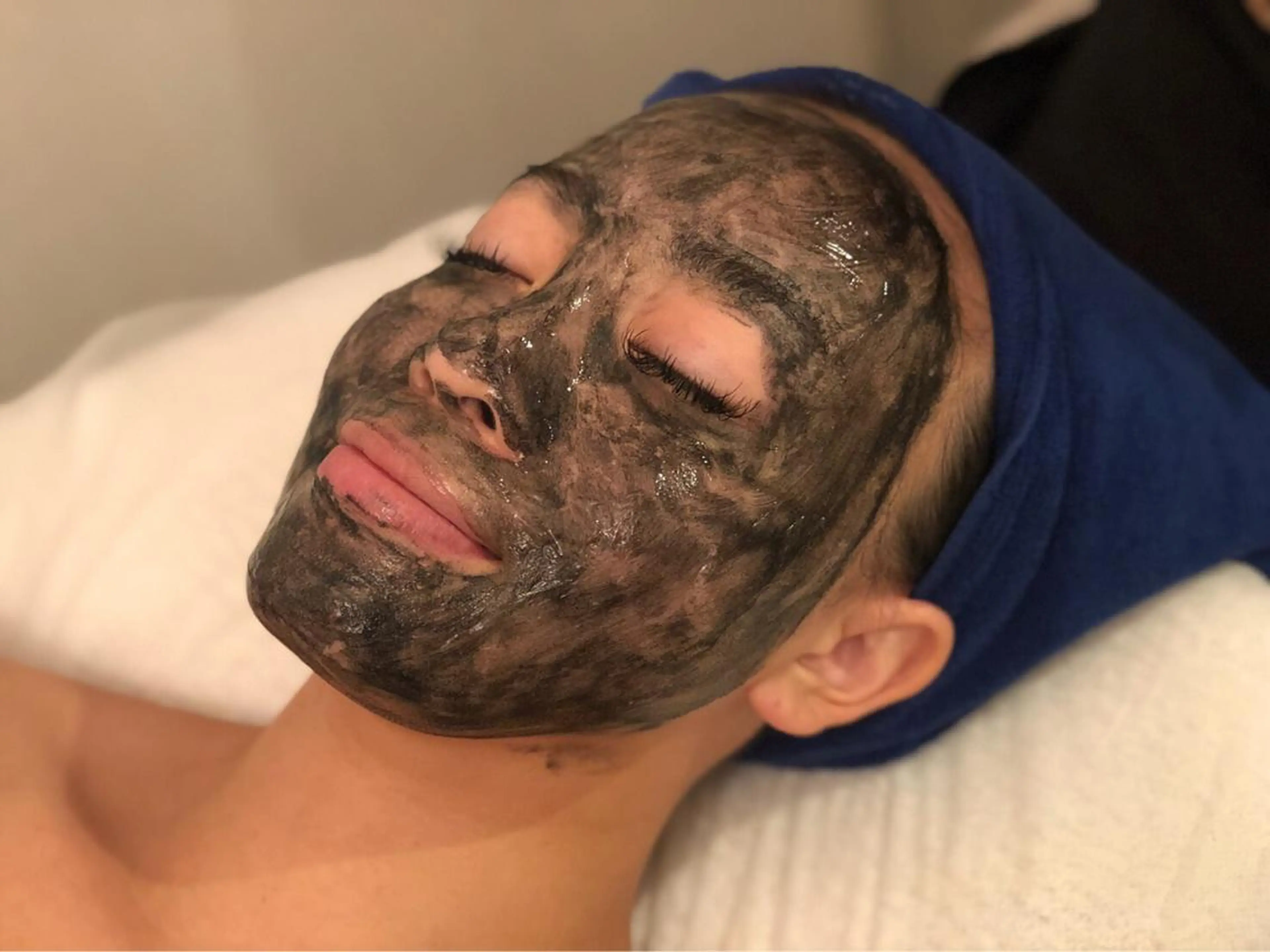 ❤️カーボンフェイシャル❤️の写真