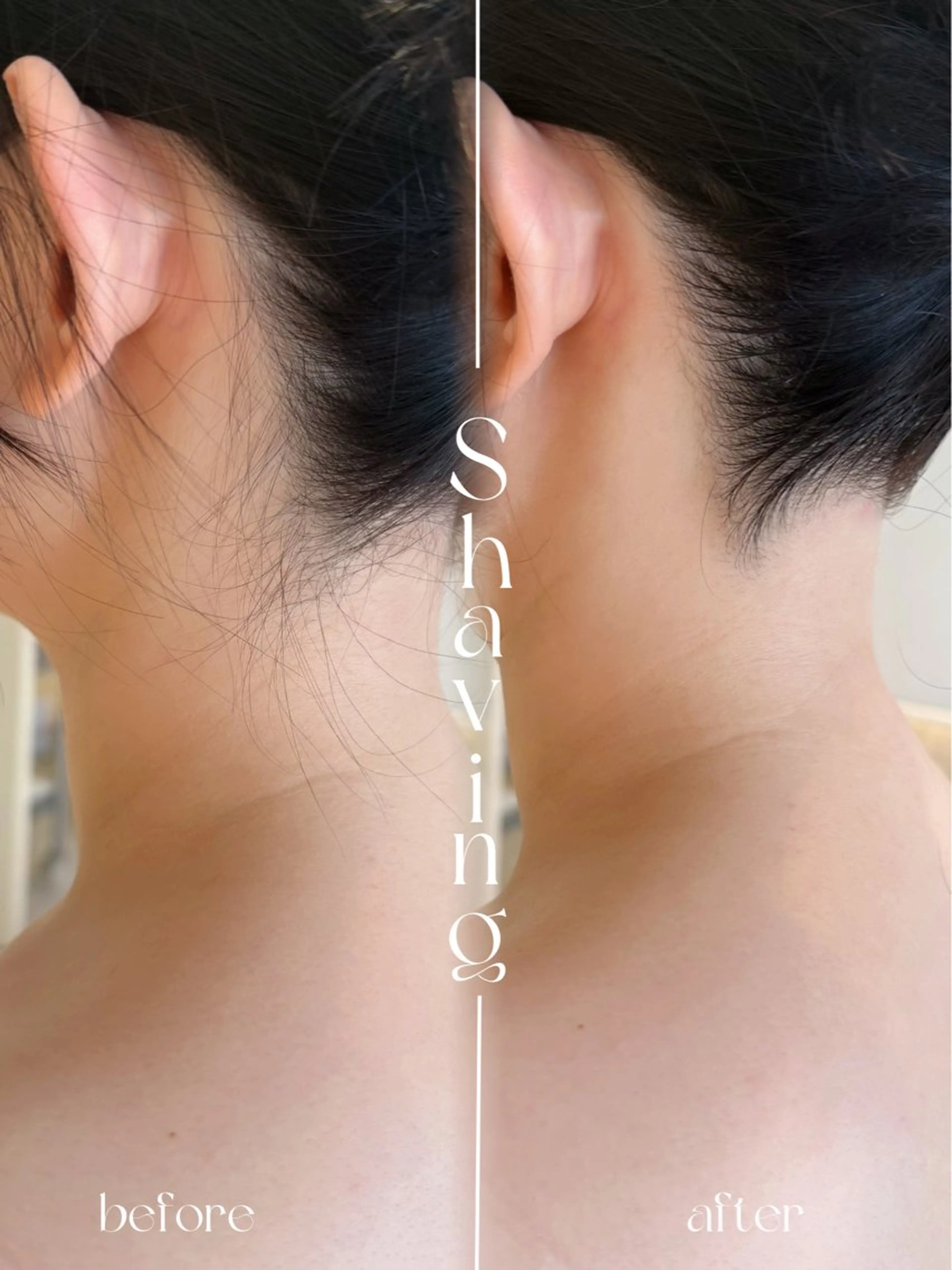 背中上+うなじ シェービング<泡洗顔、ゴマージュ サービス>の写真