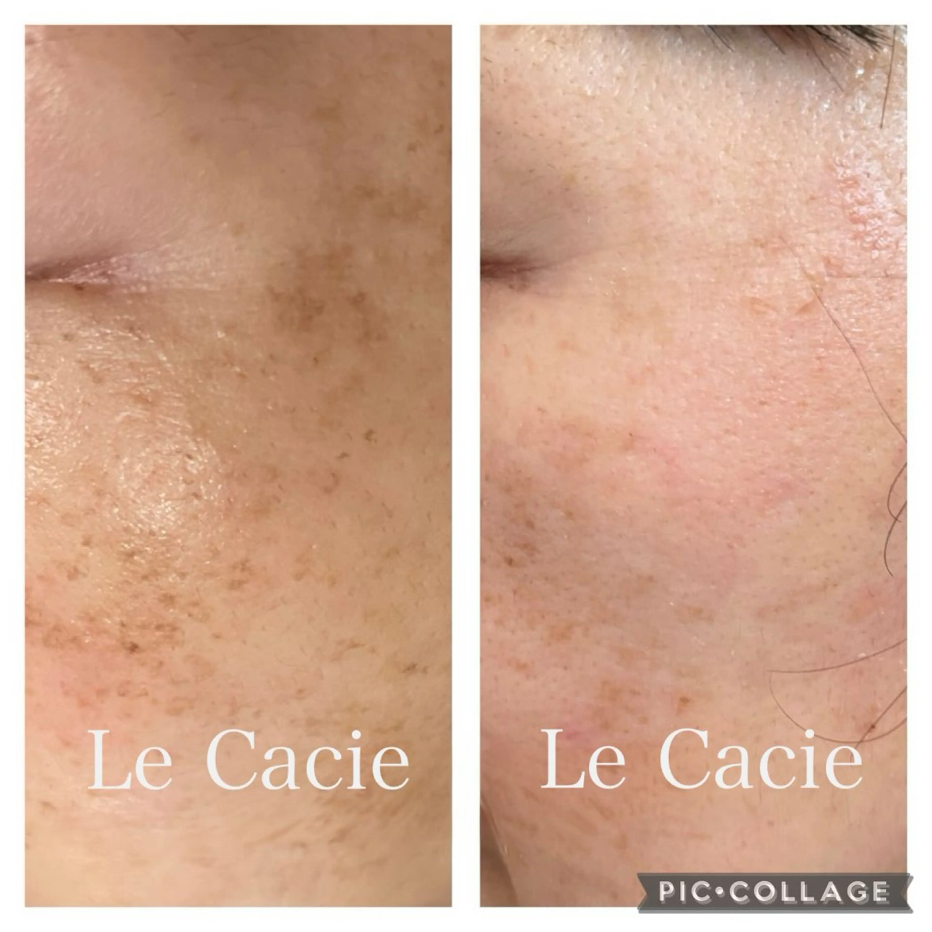 肌管理サロン ル・カシエのエステ・リラクイメージ