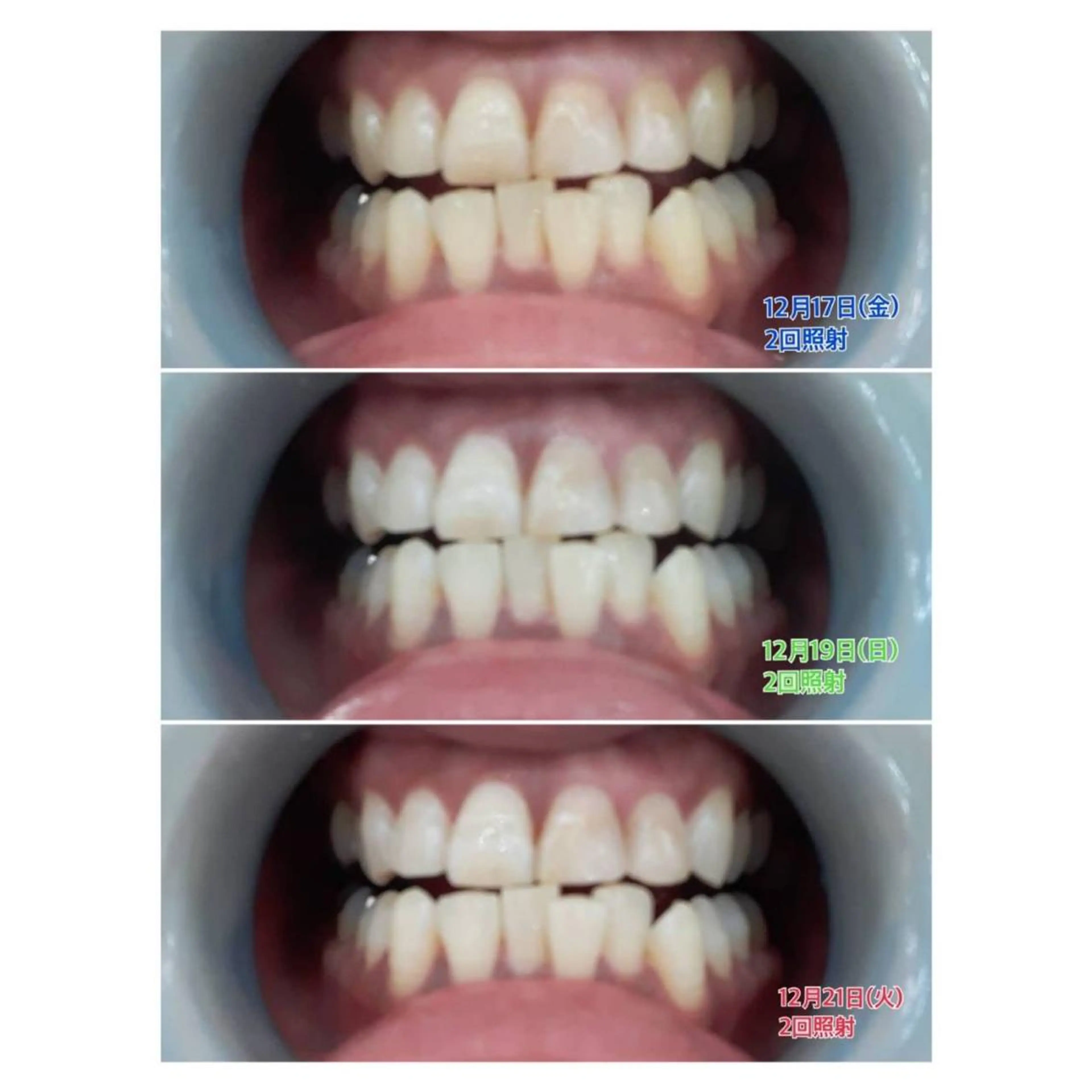 MBEAUTYSALON 千葉店・京成大久保所属・Melty 輝のその他イメージ