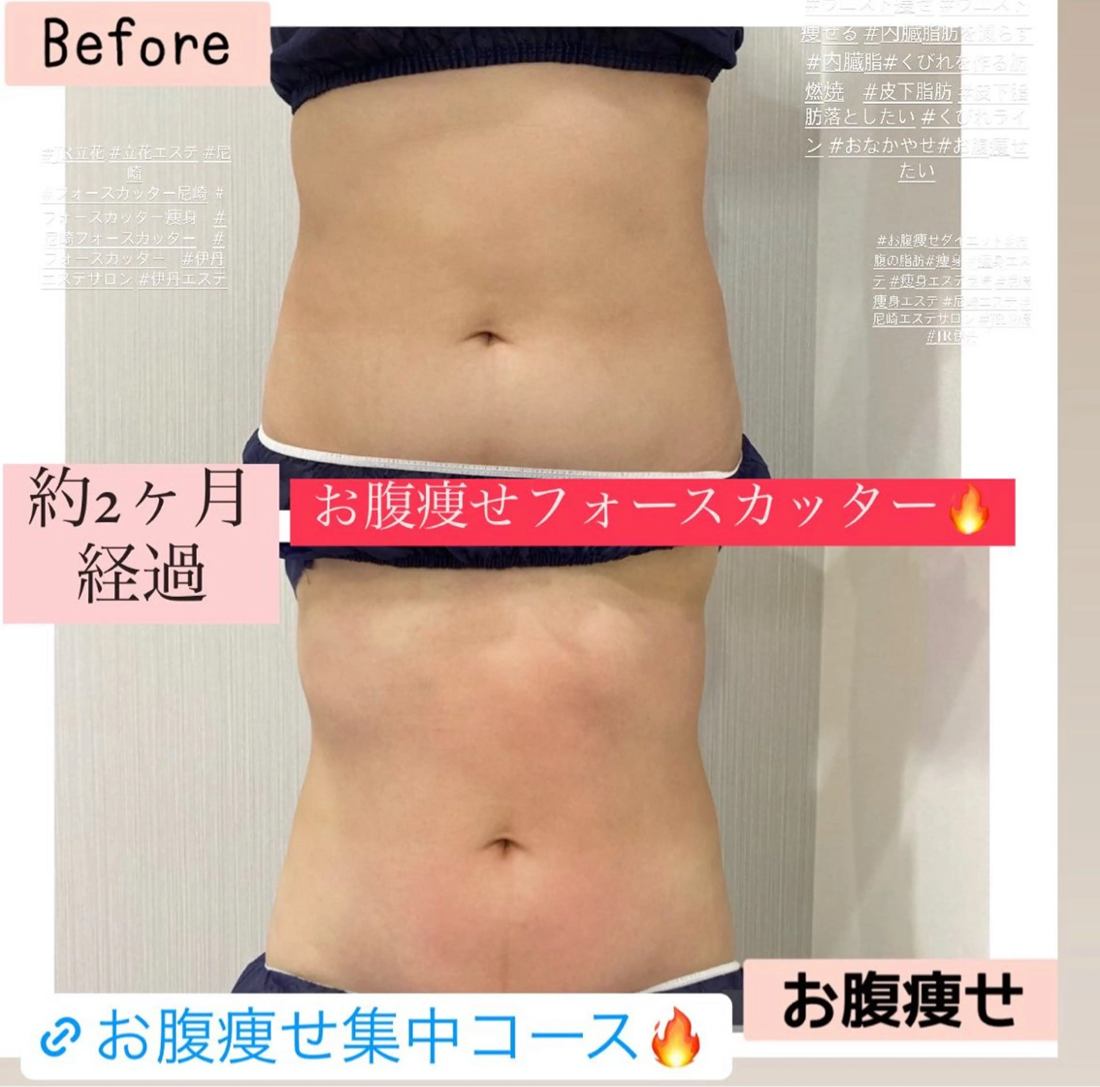 エステ ブライダル痩身×脱毛 尼崎駅前サロンのエステ・リラクイメージ