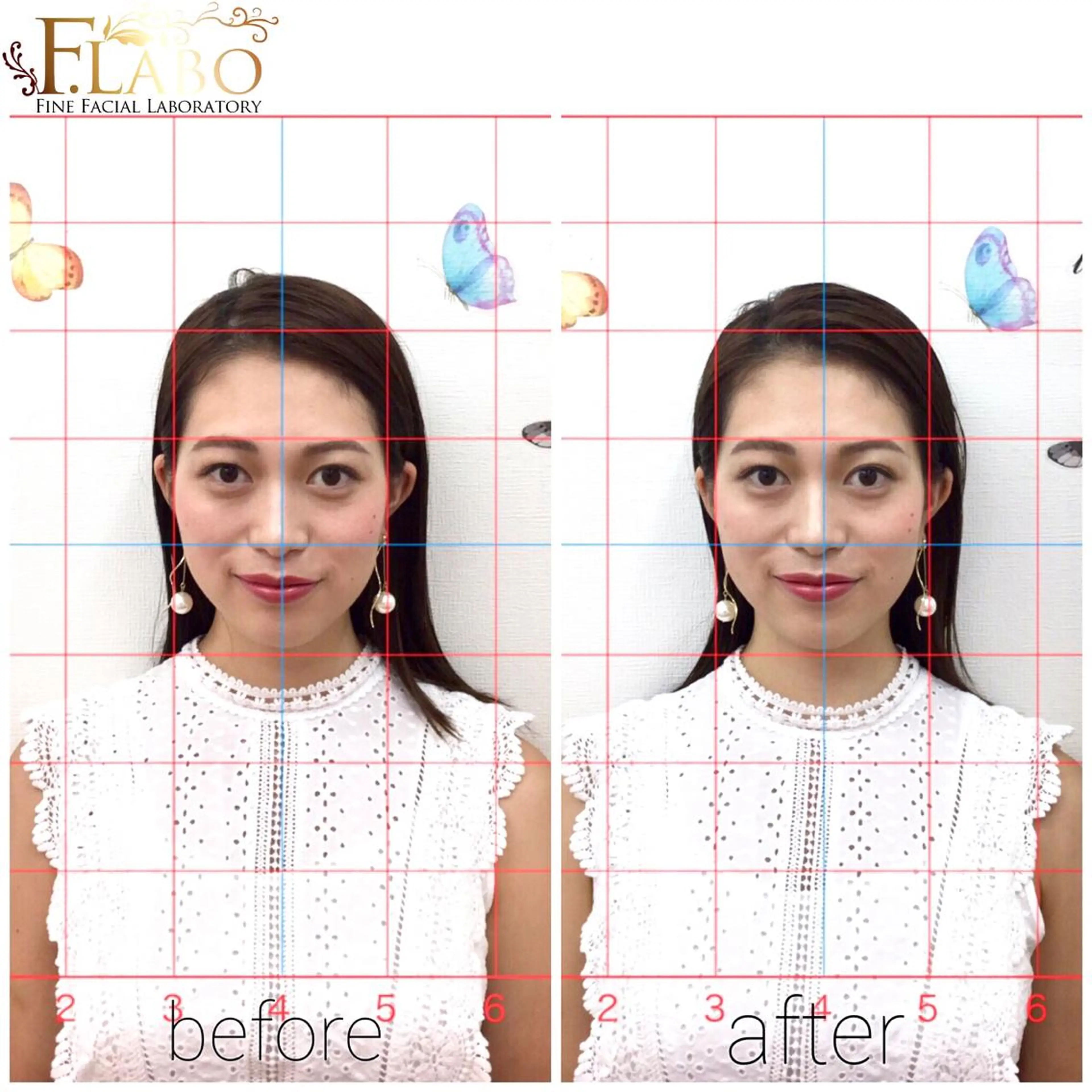 【小鼻の黒ずみや毛穴ケアがしたい方】お試しフェイシャルの写真