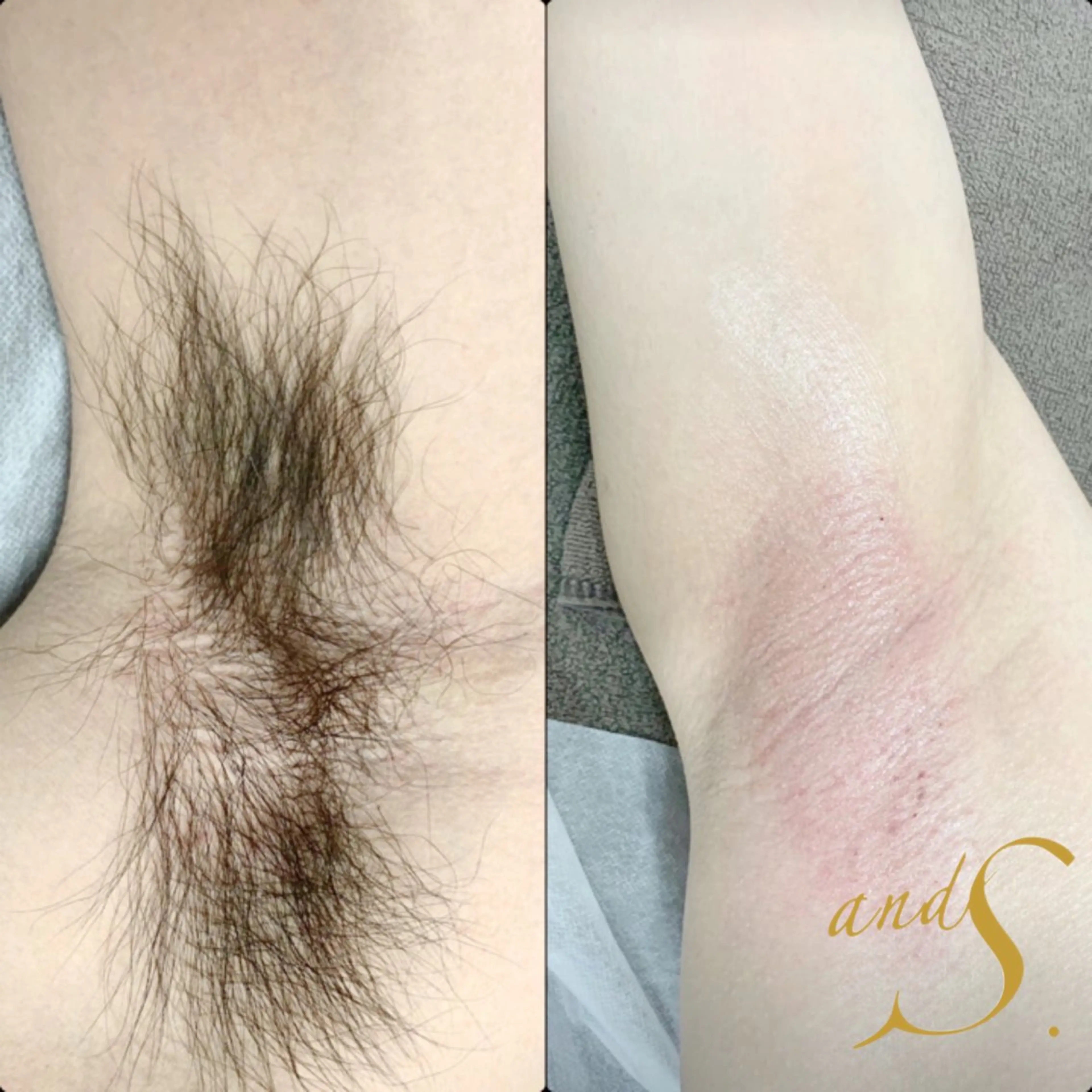 メンズ 脱毛 🌸🧡六本木 脱毛しずか🧡🫧の眉毛・アイブロウイメージ