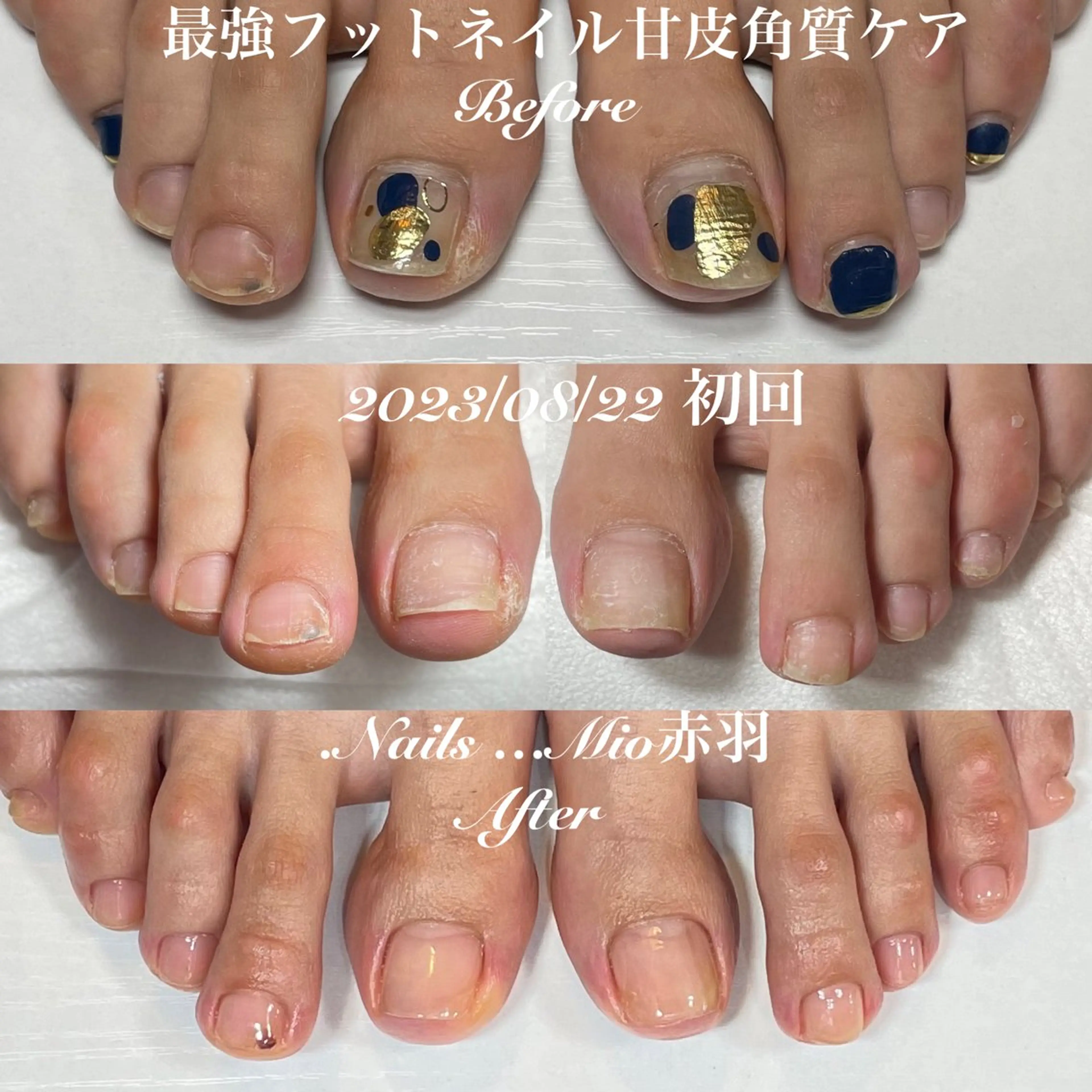 ネイル フットネイル ジェルネイル .Nails Mio 赤羽西ネイルサロンのネイルデザイン