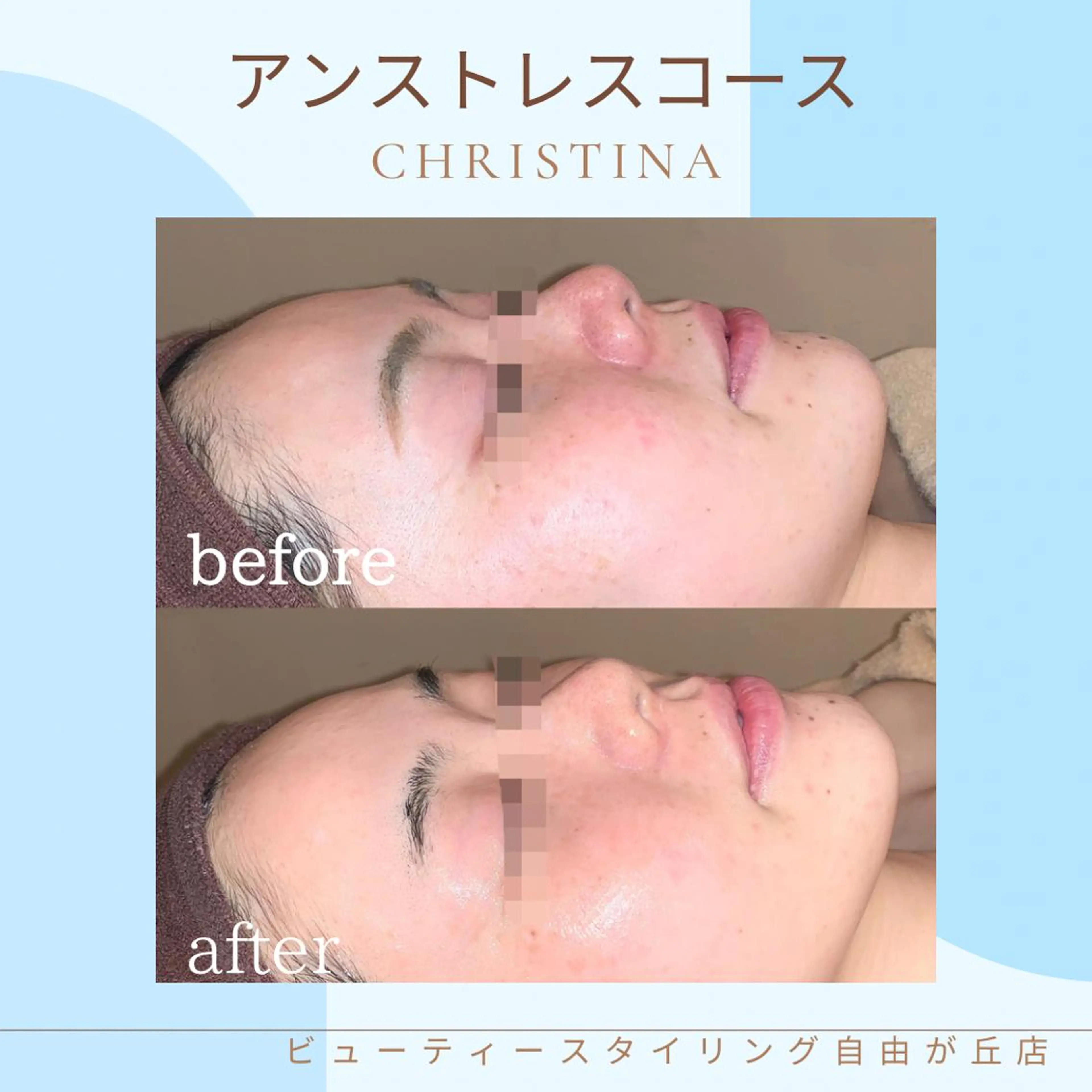 エステ 痩身＆美肌サロン 三浦のその他イメージ