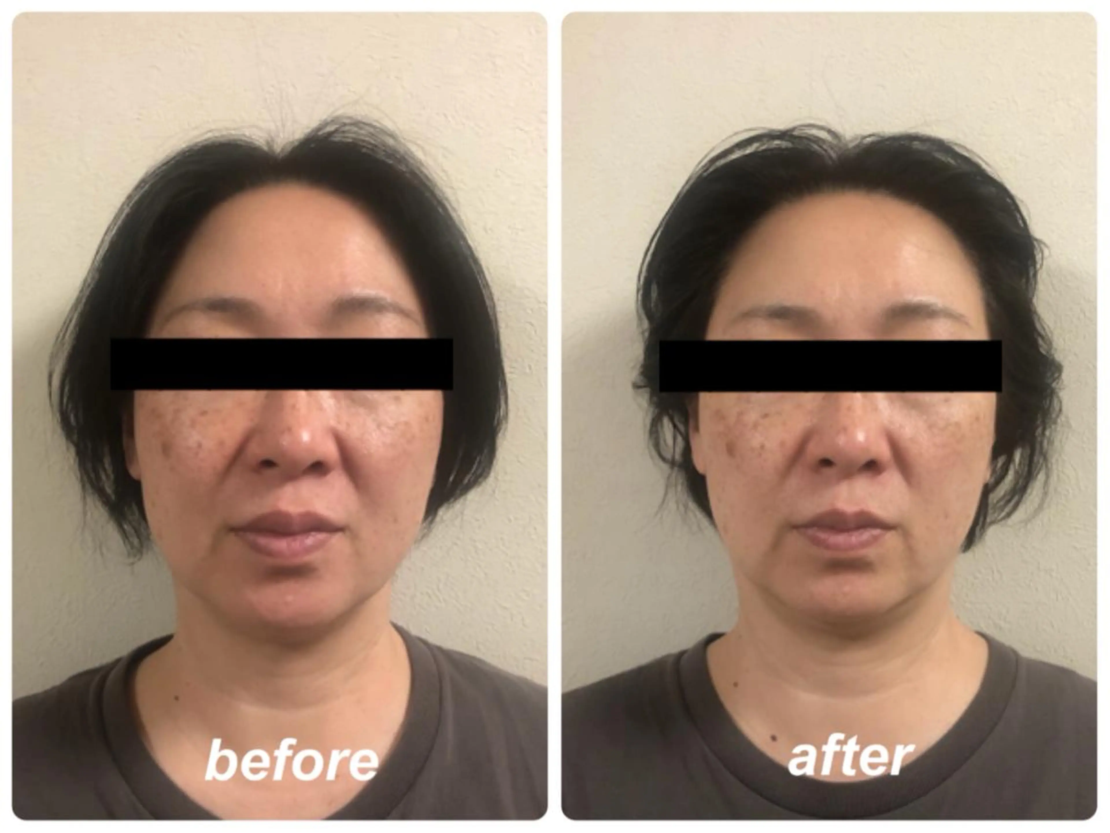 Radiance H.Oのエステ・リラクイメージ