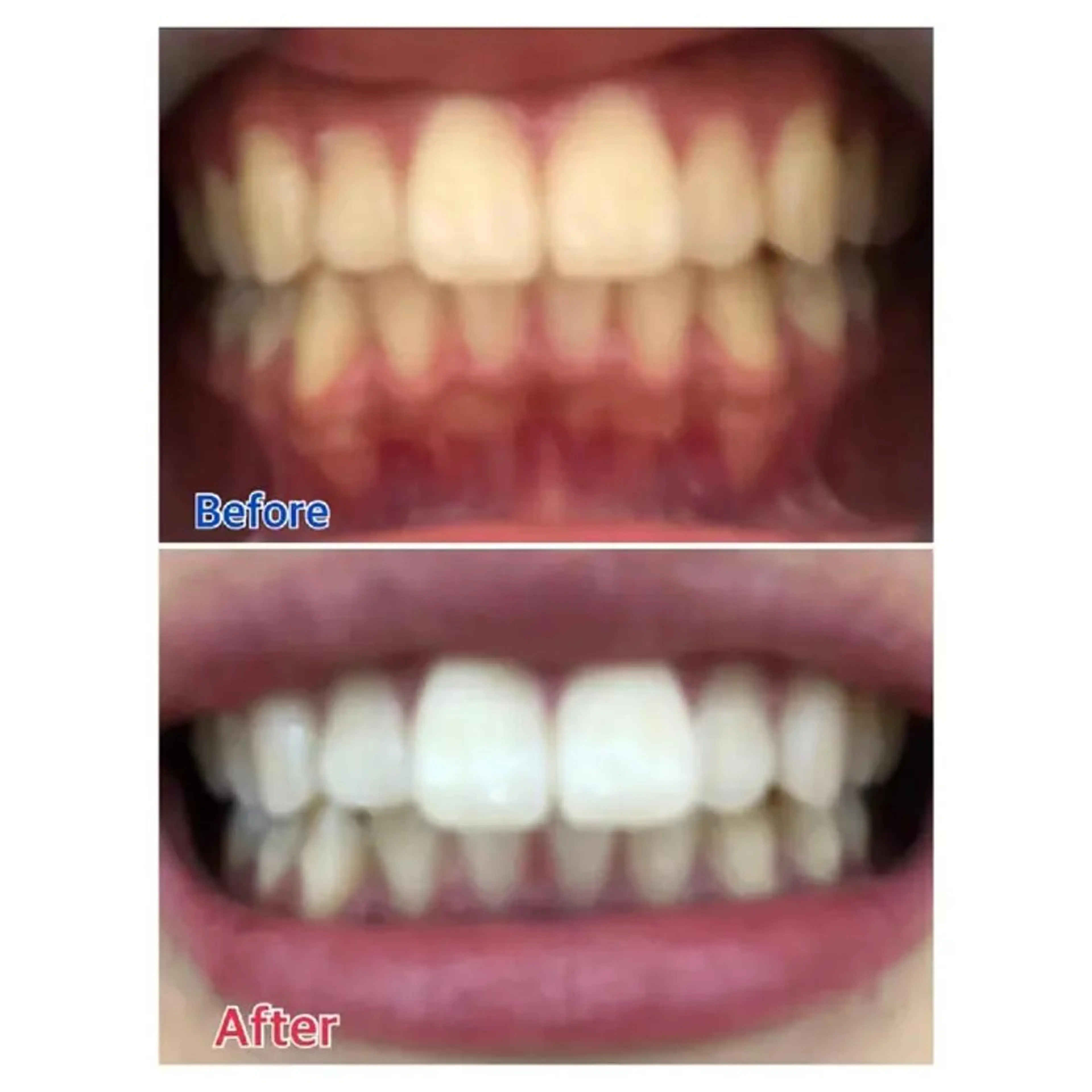 M渋谷店所属・Ｍ渋谷 ホワイトニングのその他イメージ