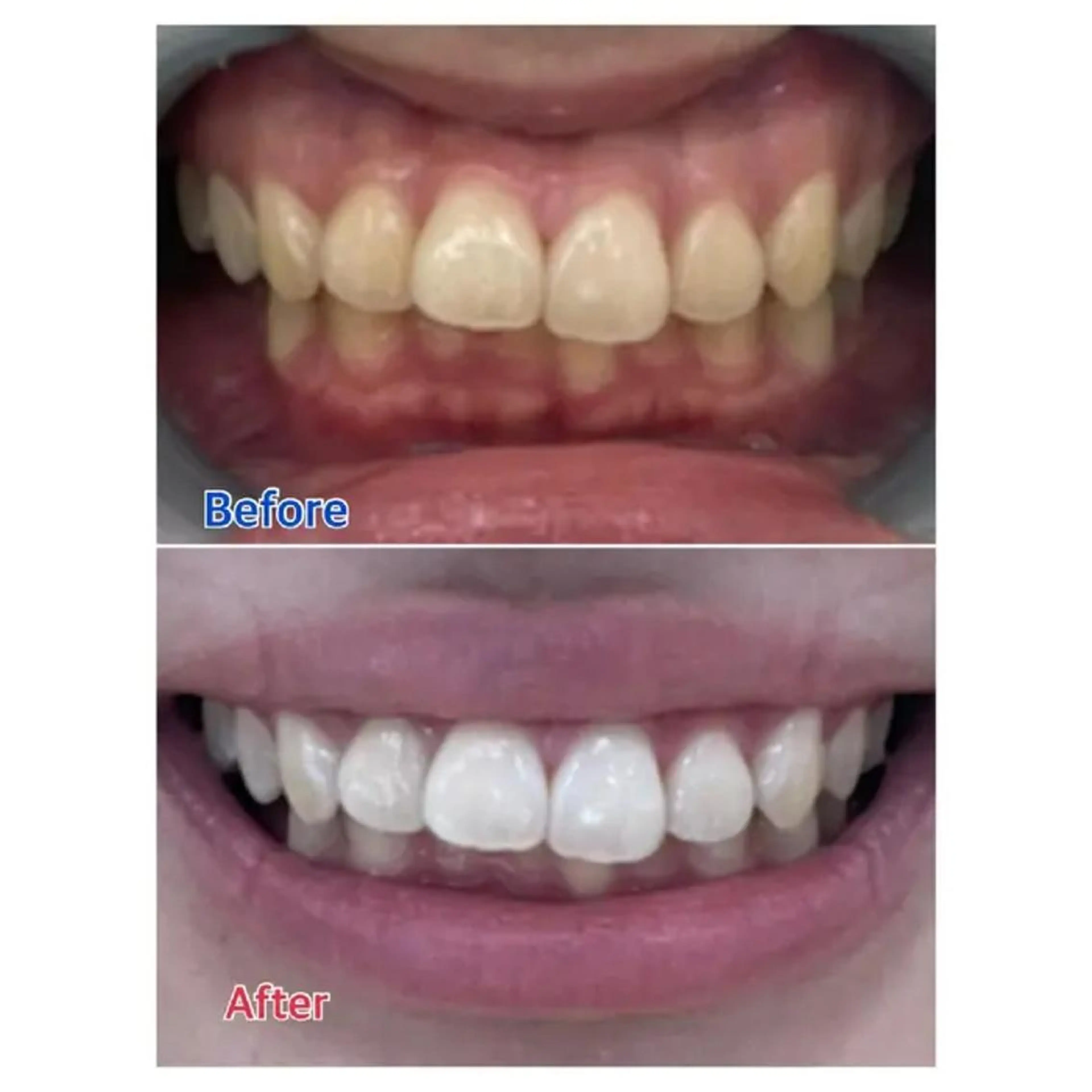 M渋谷店所属・M渋谷 ホワイトニングのエステ・リラクイメージ