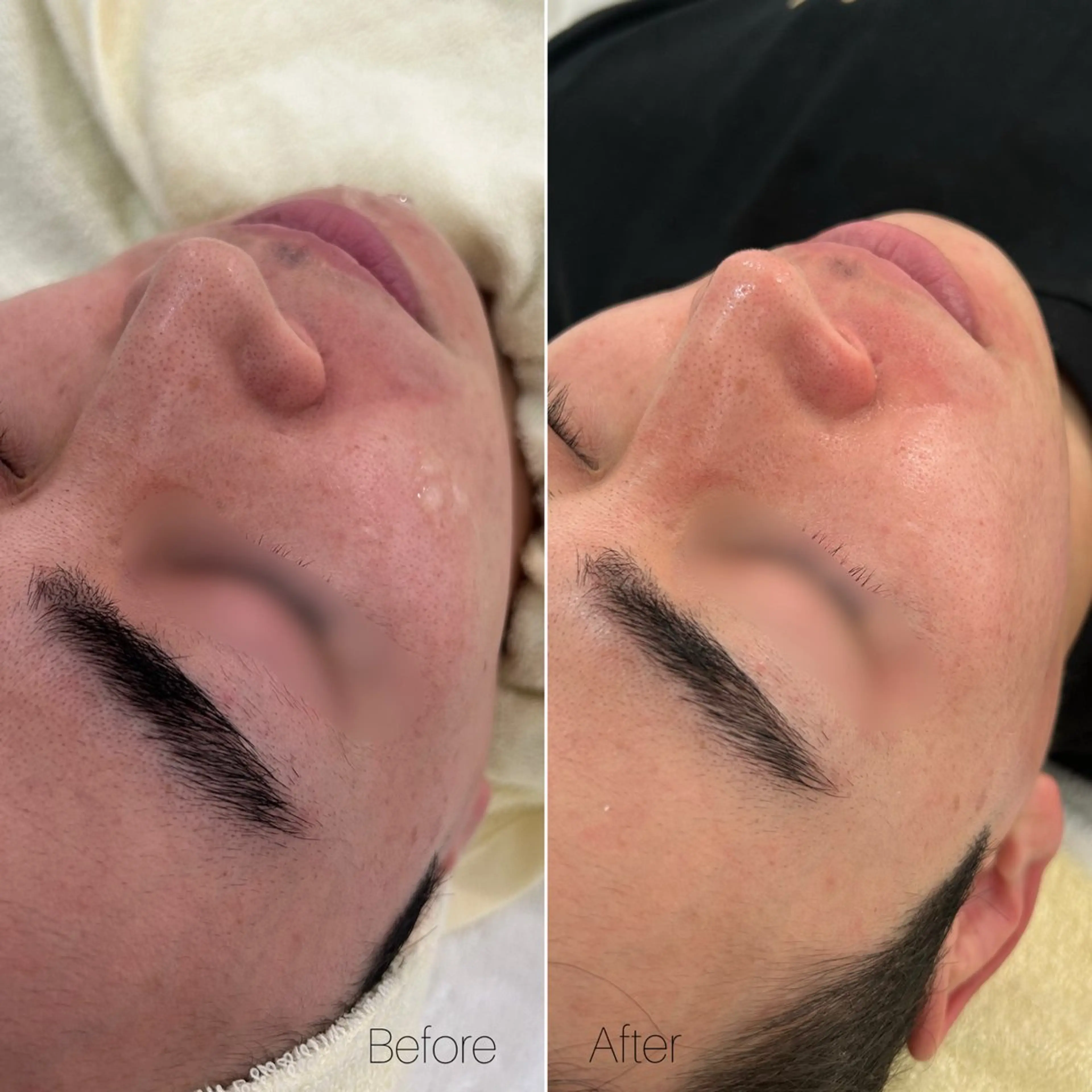 〈etre〉トータルビューティーサロン所属・etre - 韓国肌管理 -のエステ・リラクイメージ