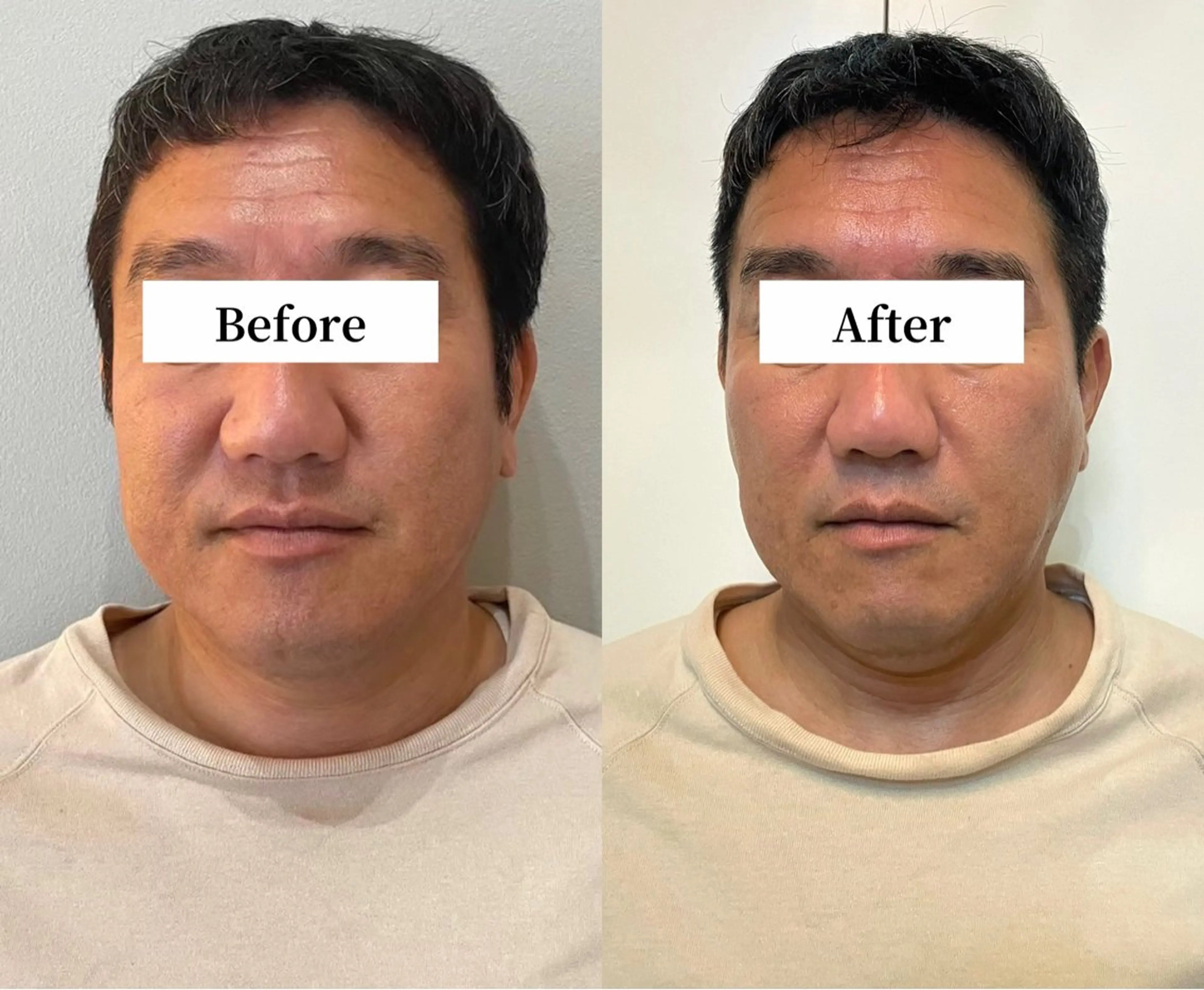 エステ リラク Private SalonOboraのエステ・リラクイメージ