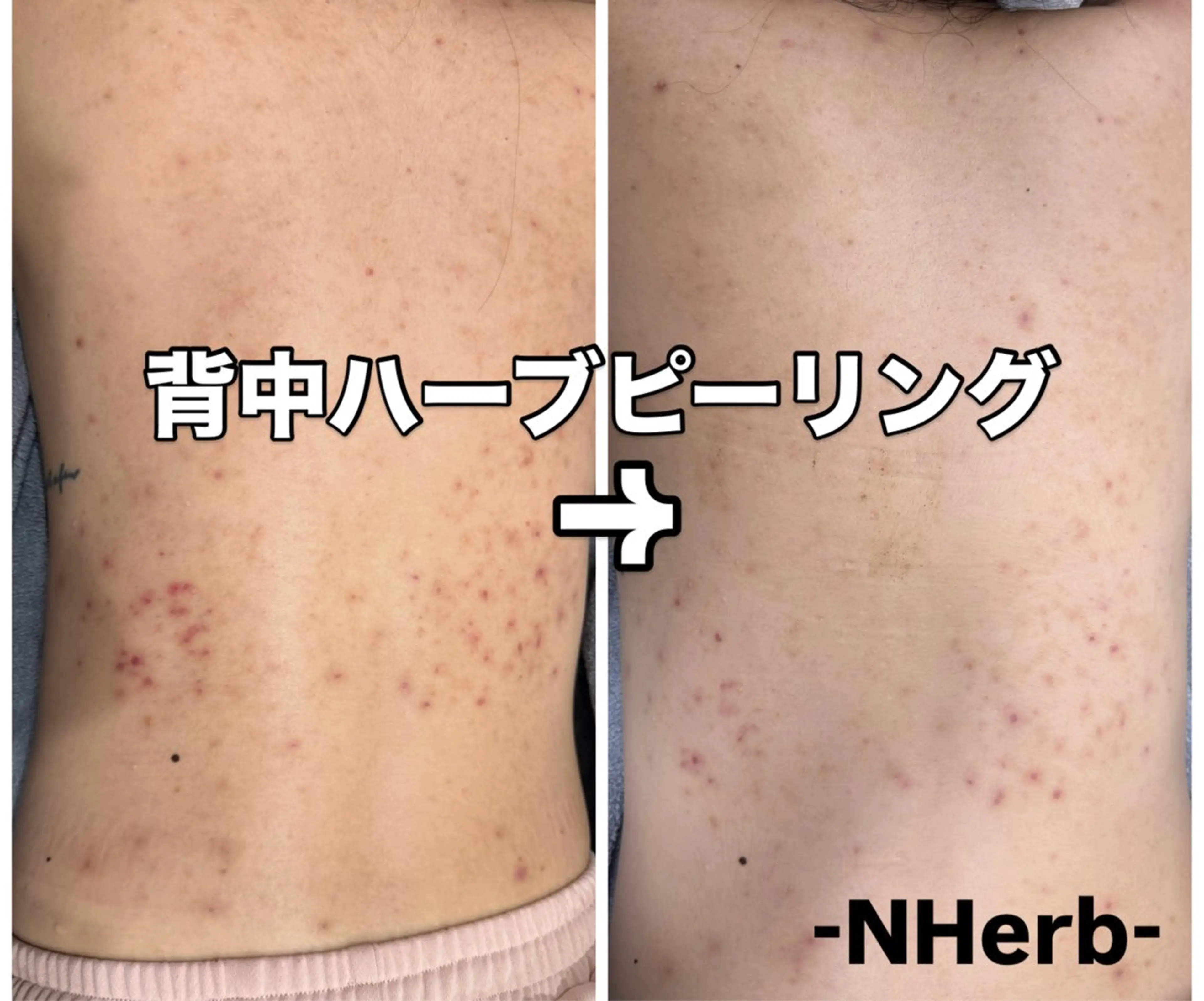 エステ NHerb【エヌハーブ】所属・横田 汐里のエステ・リラクイメージ