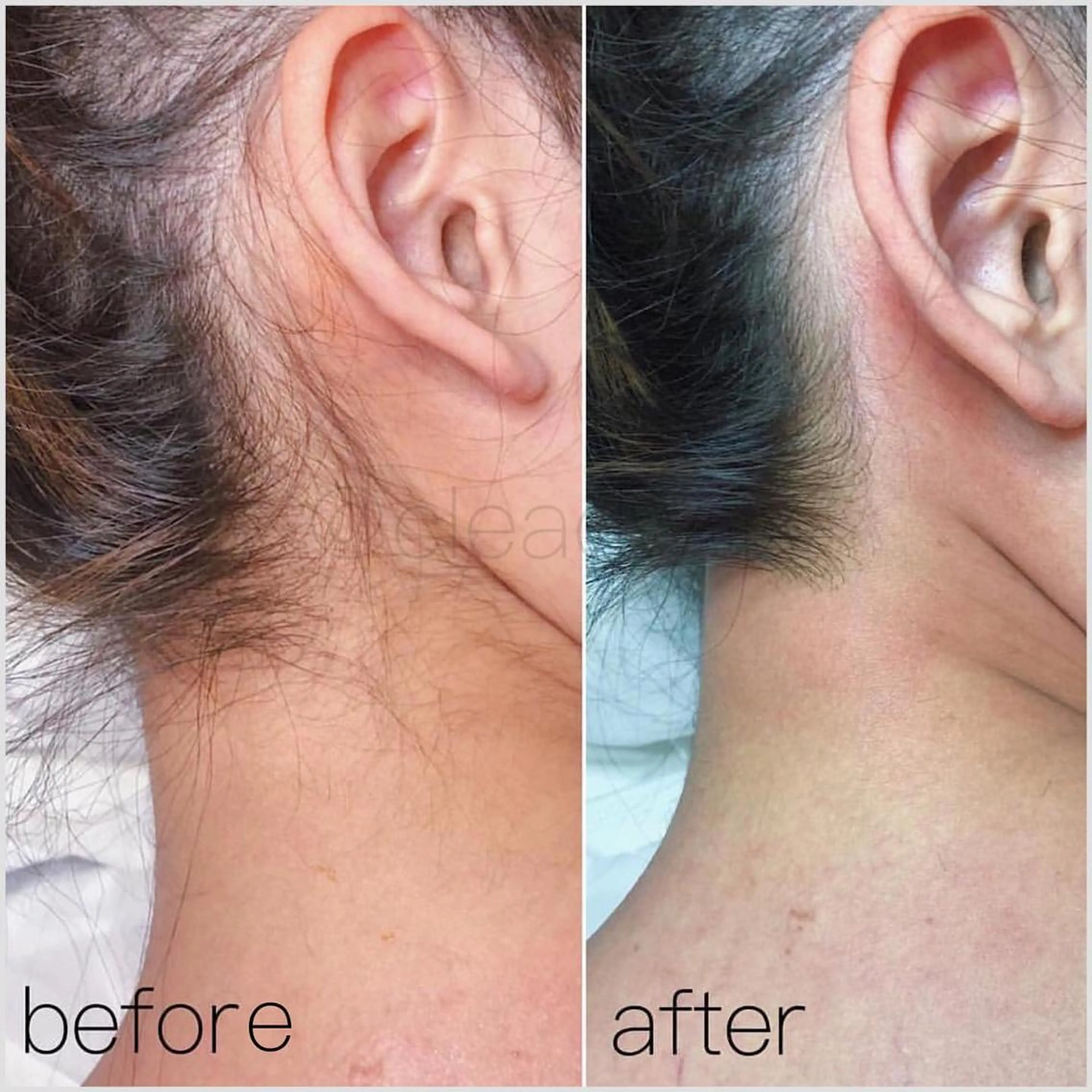 CLEAD赤坂見附店 坂田のエステ・リラクイメージ