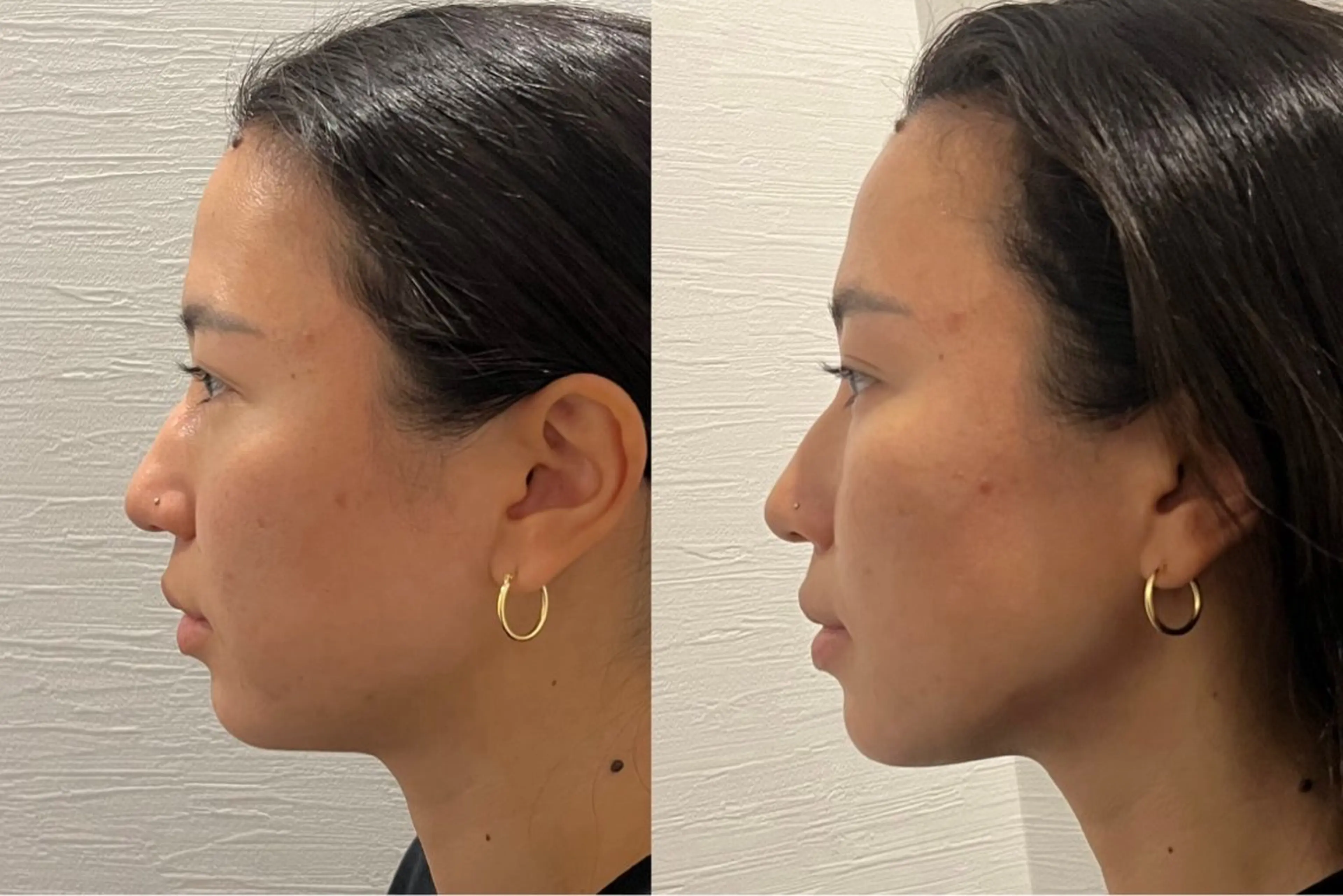 その他 NANI OAFU所属・NANIOAFU [なんば店］のその他イメージ