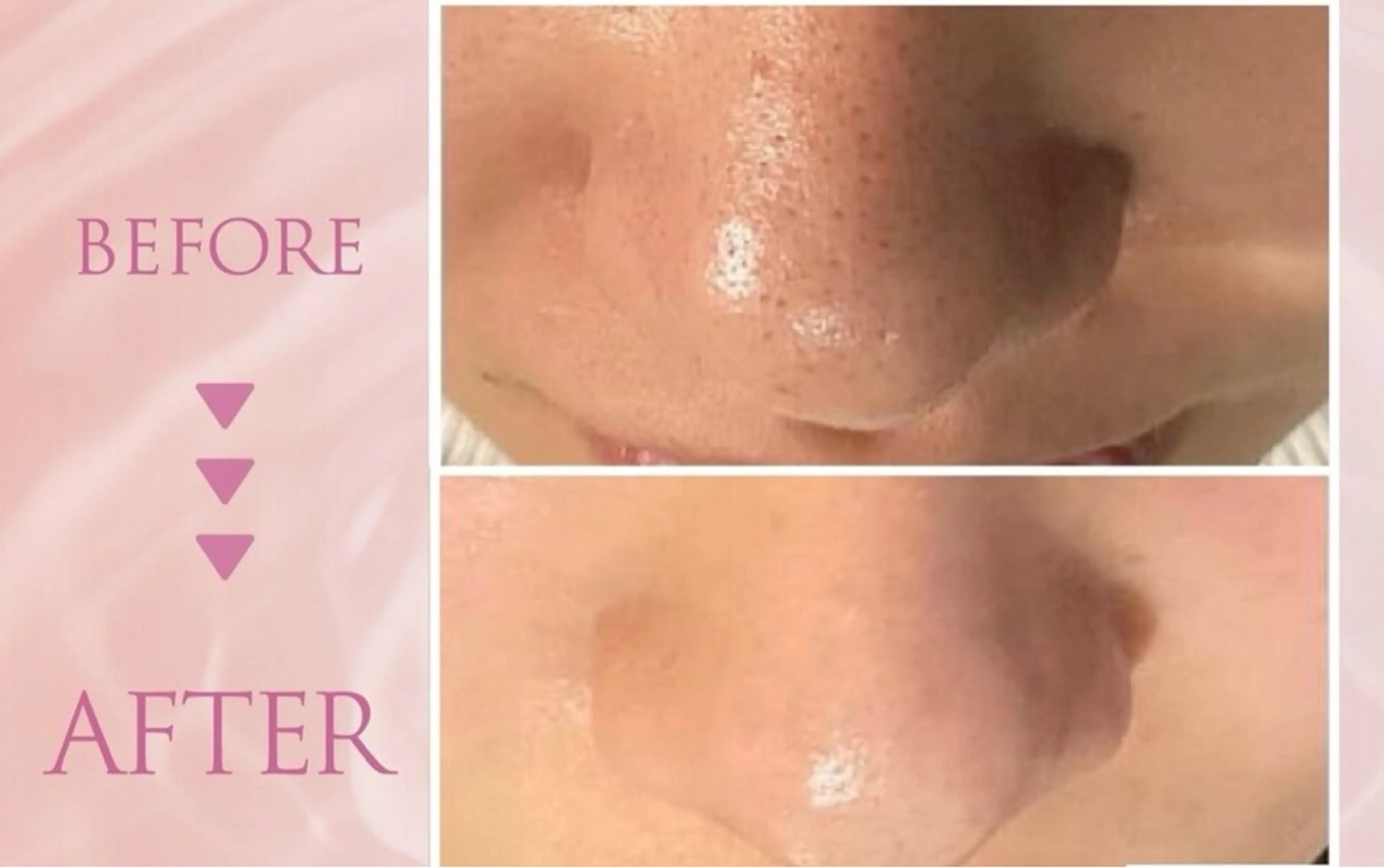 韓国肌管理専門店 Clear Lab 池袋所属・韓国肌管理専門店 池袋店REIKAのエステ・リラクイメージ